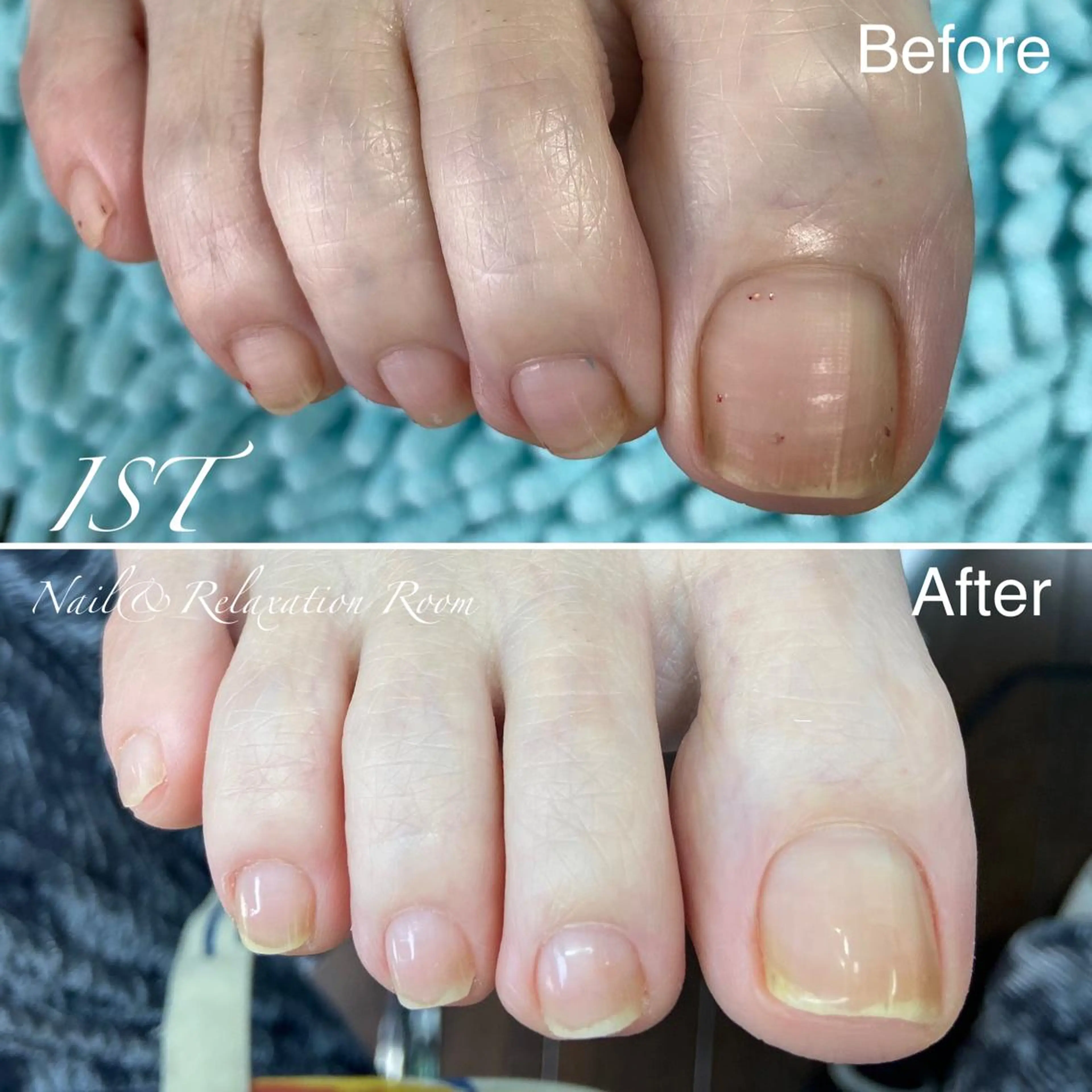 ネイル メンズ歓迎🙆‍♀️ エステ/ネイルISTのネイルデザイン