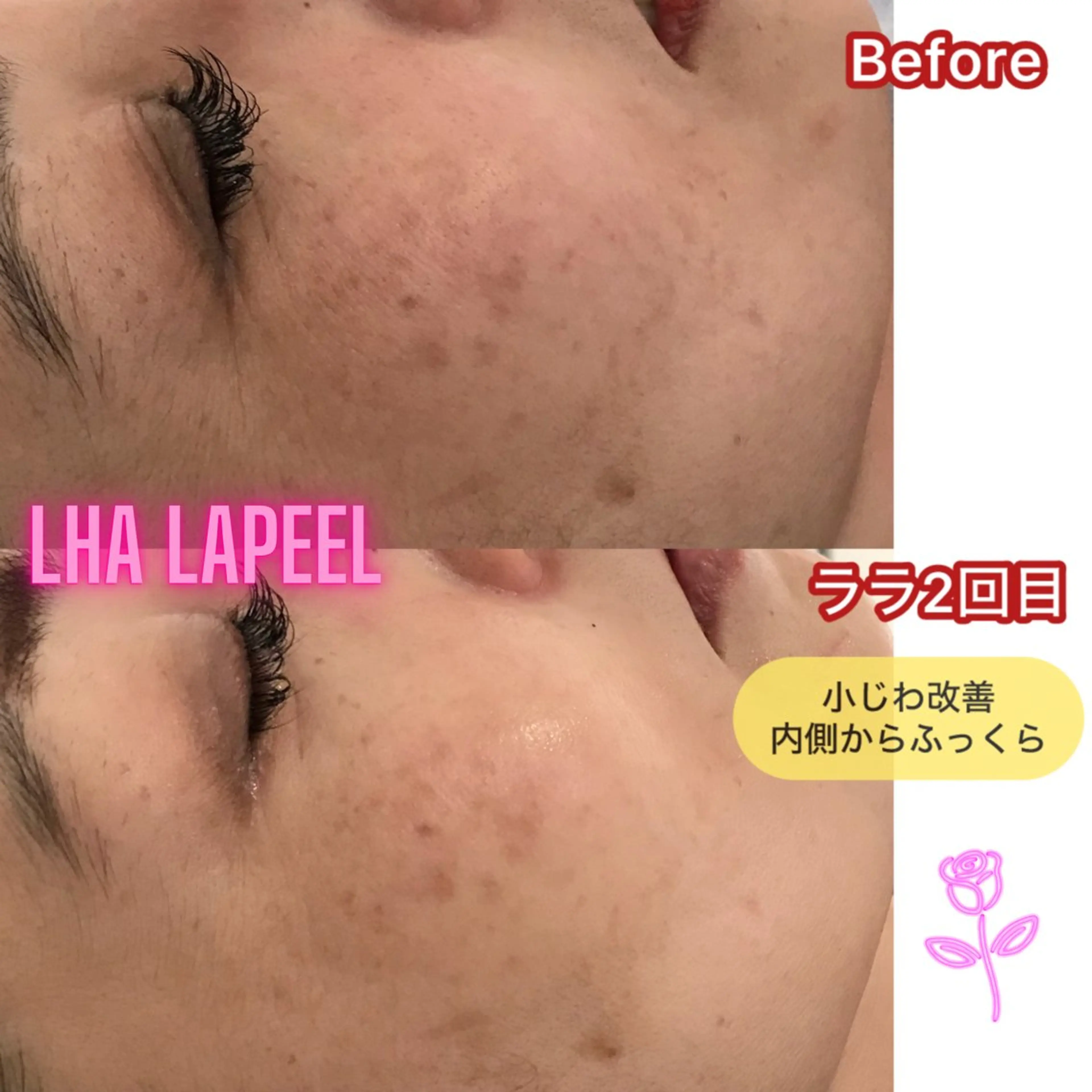 天神 MeMeのエステ・リラクイメージ