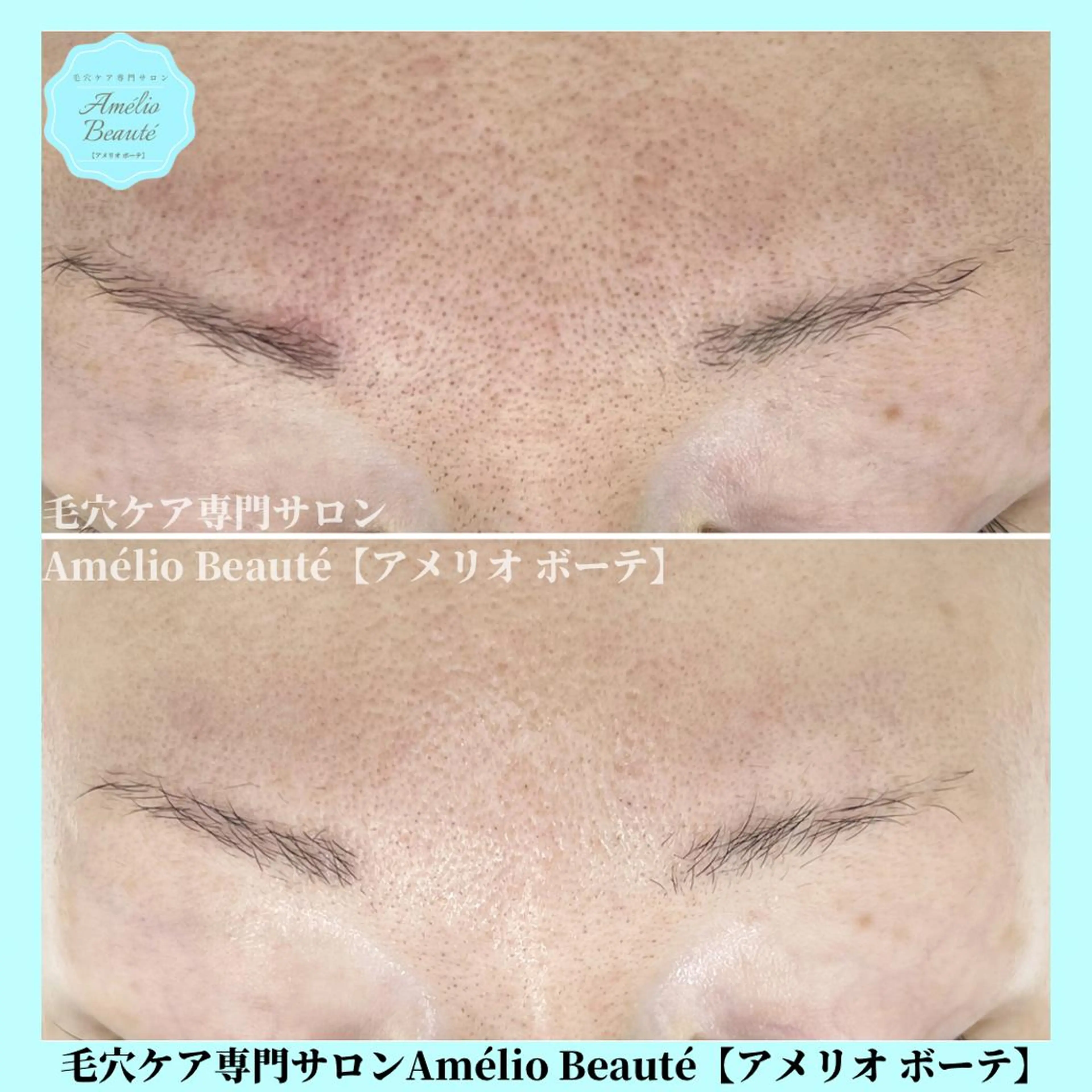 毛穴ケア専門サロン Amélio Beauté所属・毛穴ケア専門サロン アメリオボーテのその他イメージ
