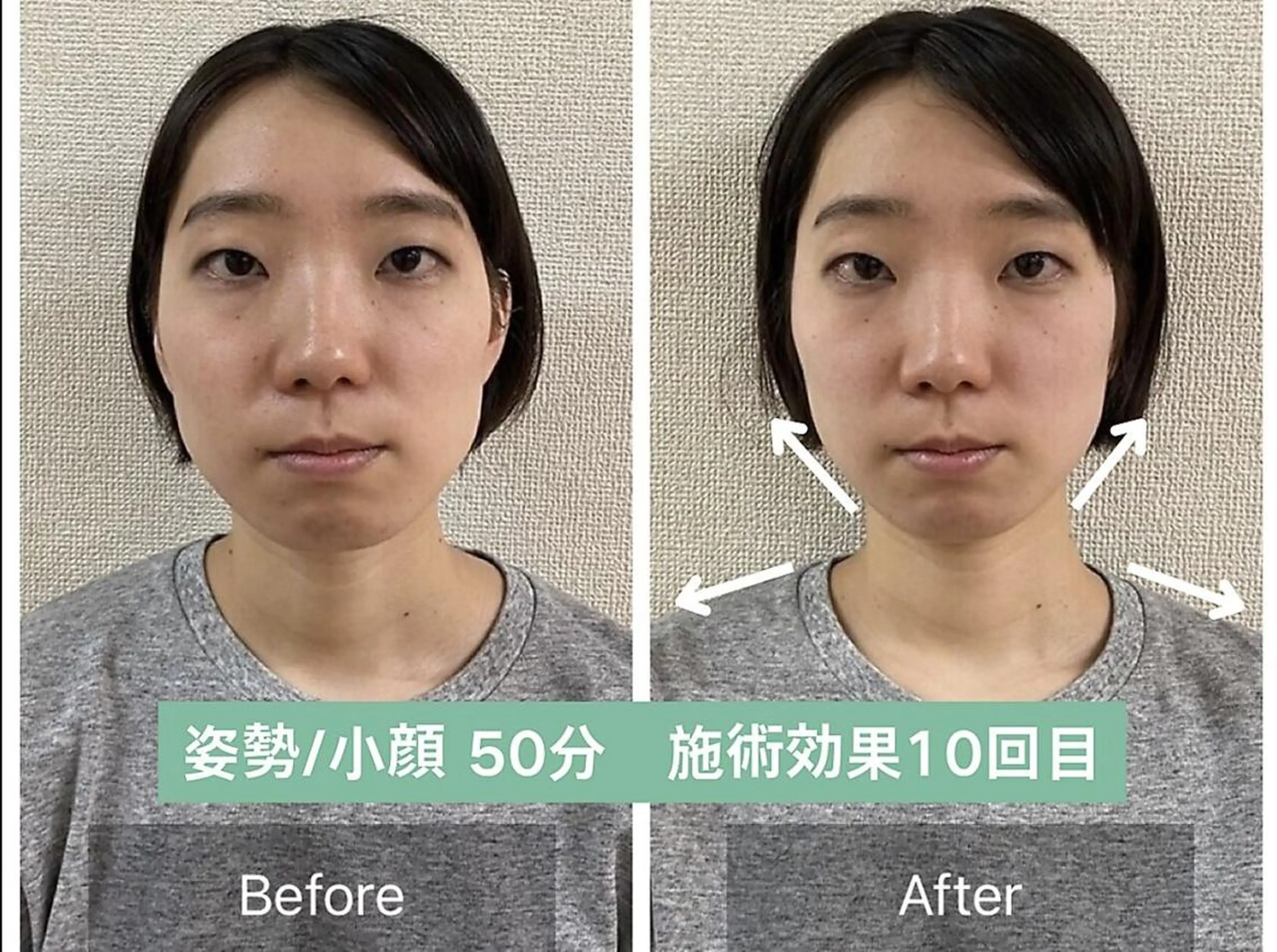 顔の左右差 歪み・猫背/骨盤調整【50分15900円】の写真