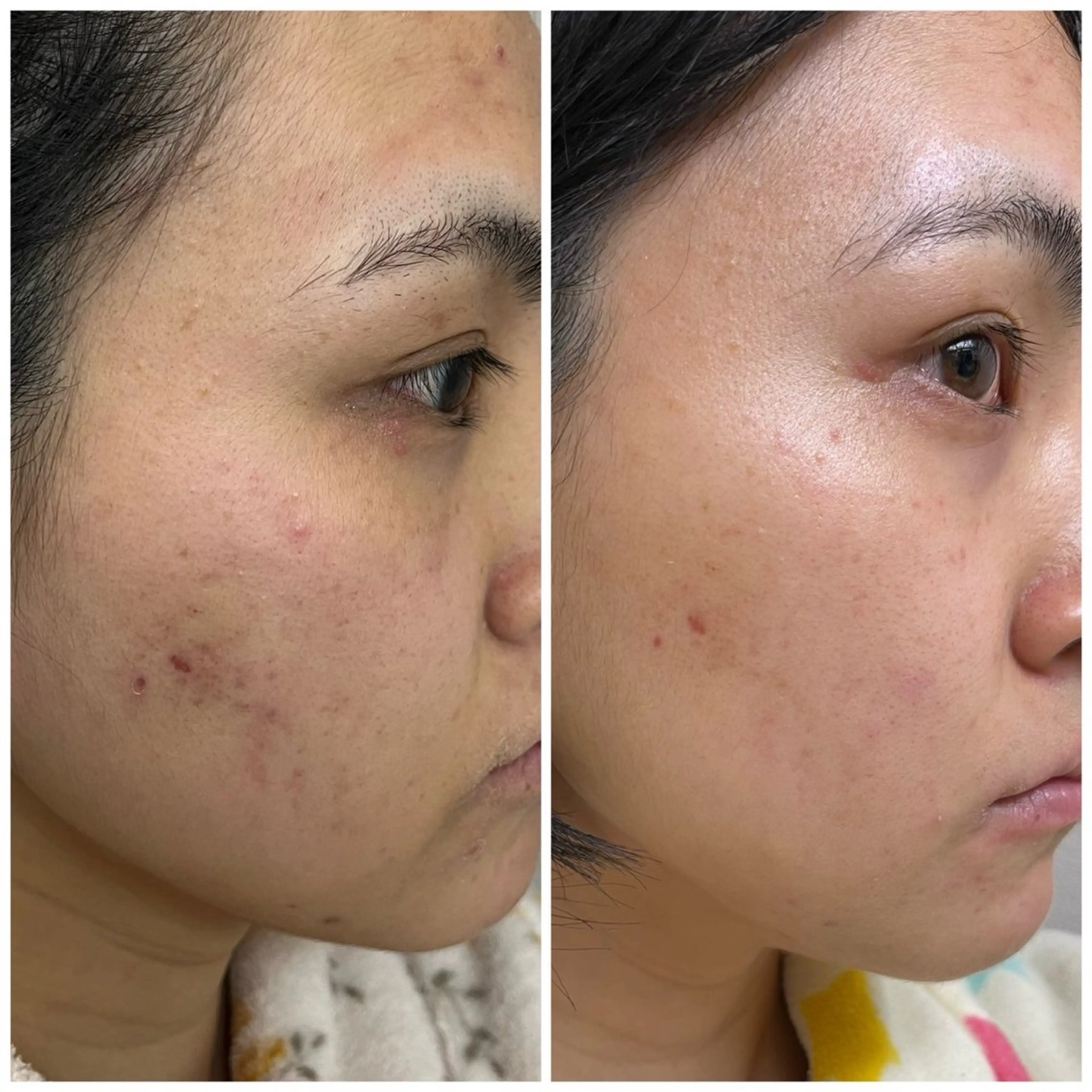 エステ デアイム一宮所属・村川 理佳のエステ・リラクイメージ