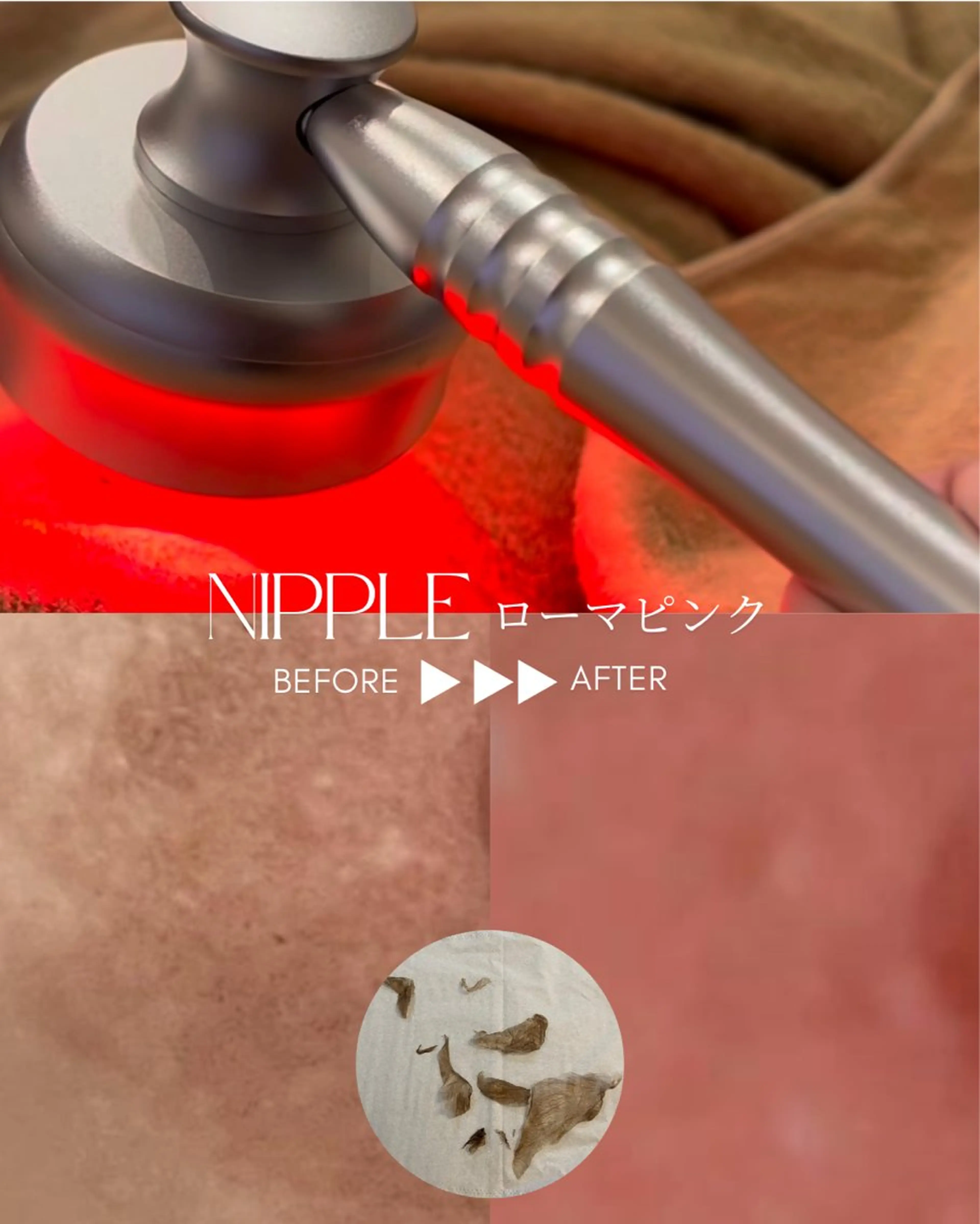 川越ローマピンク 光脱毛＆ワックス脱毛のエステ・リラクイメージ