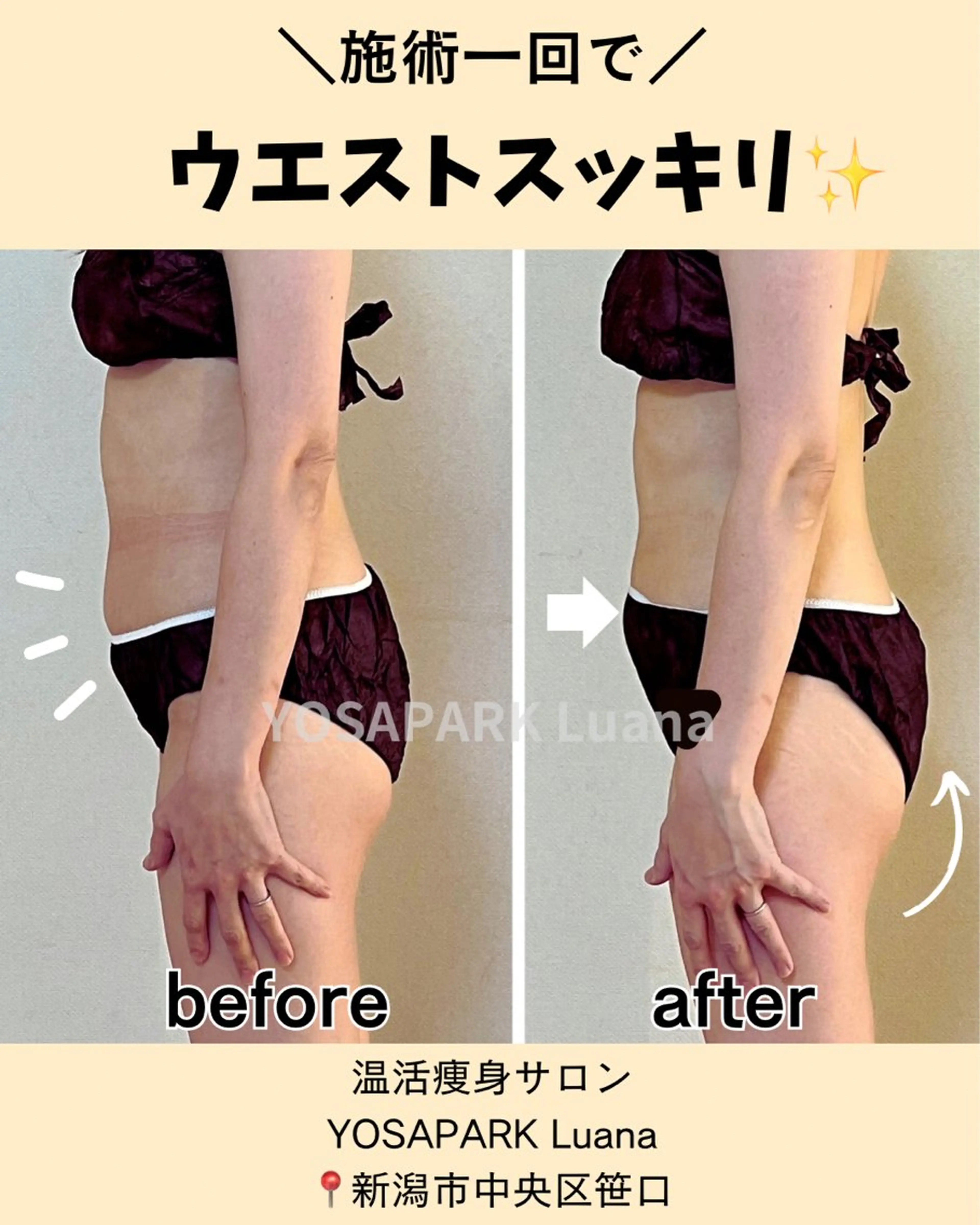 YOSAPARK Luana【ヨサパークルアナ】所属・YOSAPARK Luanaのその他イメージ