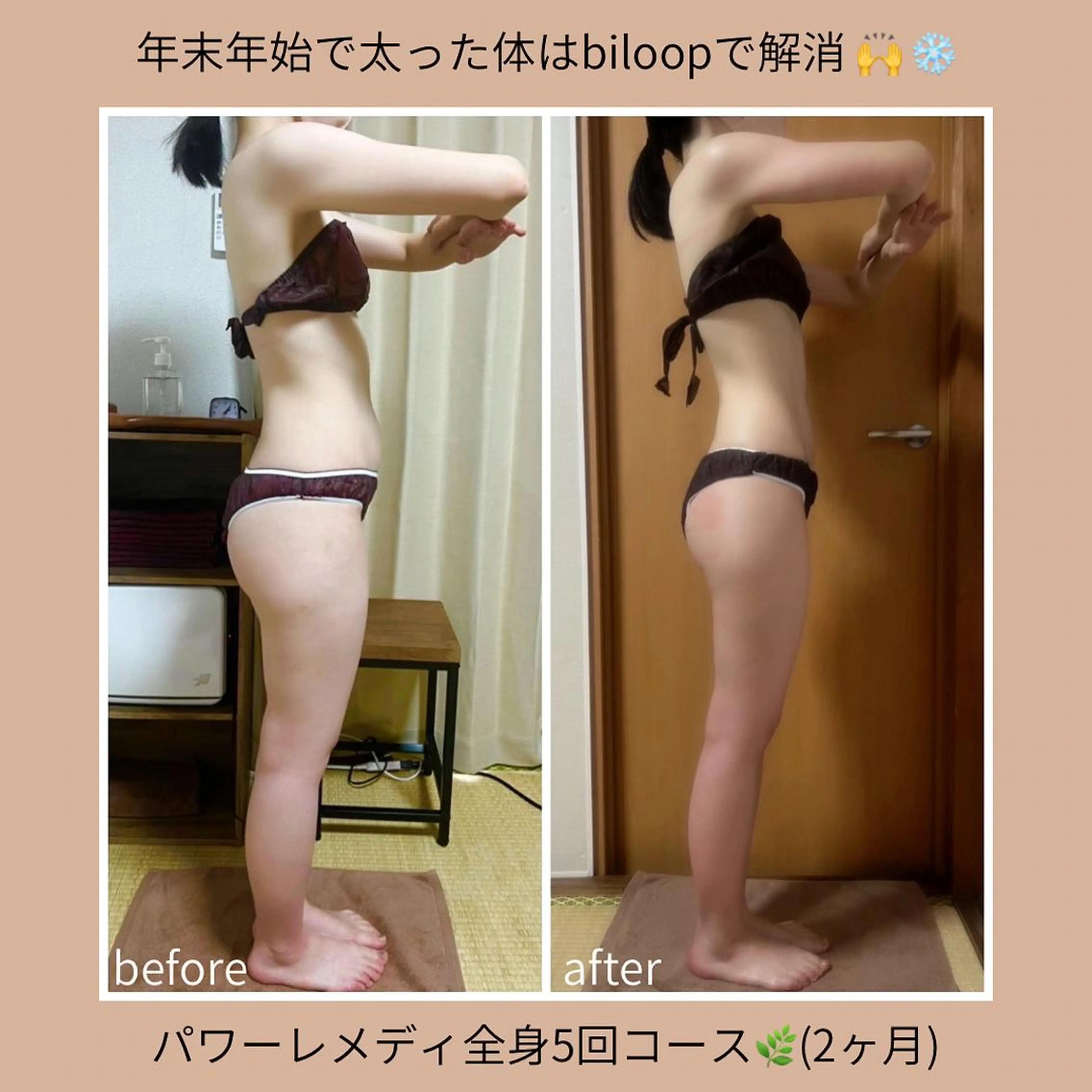 biloop所属・《本気痩せ×疲労改善 》  BILOOPのエステ・リラクイメージ