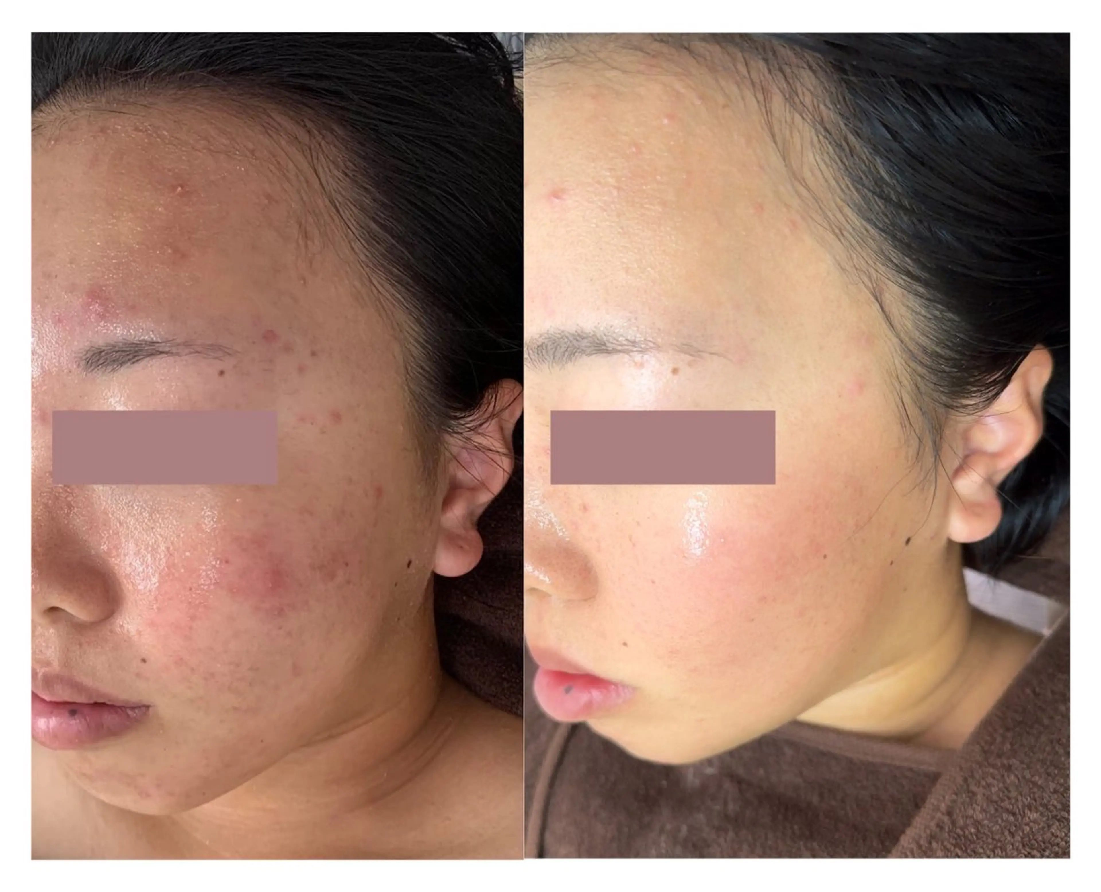 プライベートサロン Grast🪴アイカのエステ・リラクイメージ