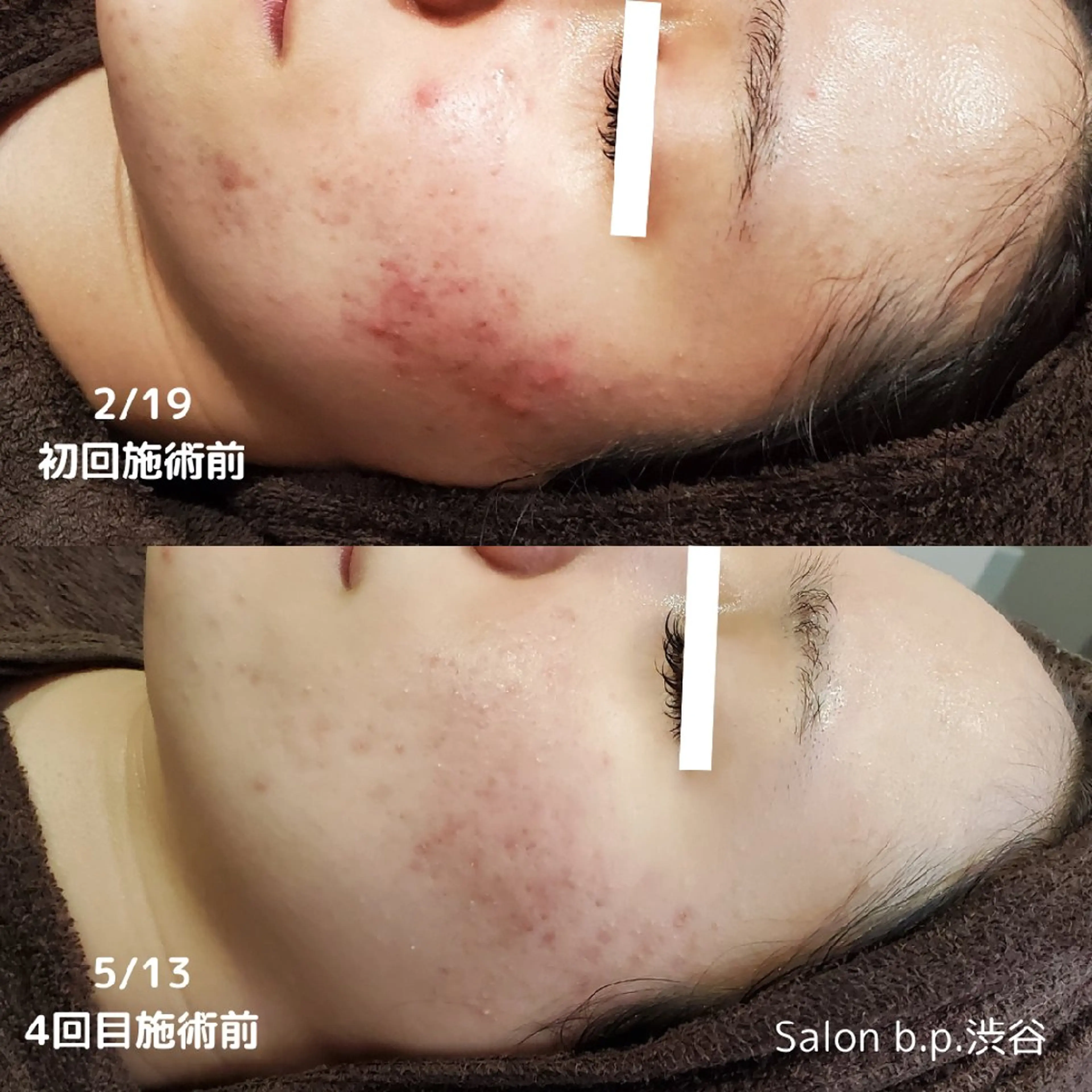 エステ Salon b.p. 渋谷のエステ・リラクイメージ