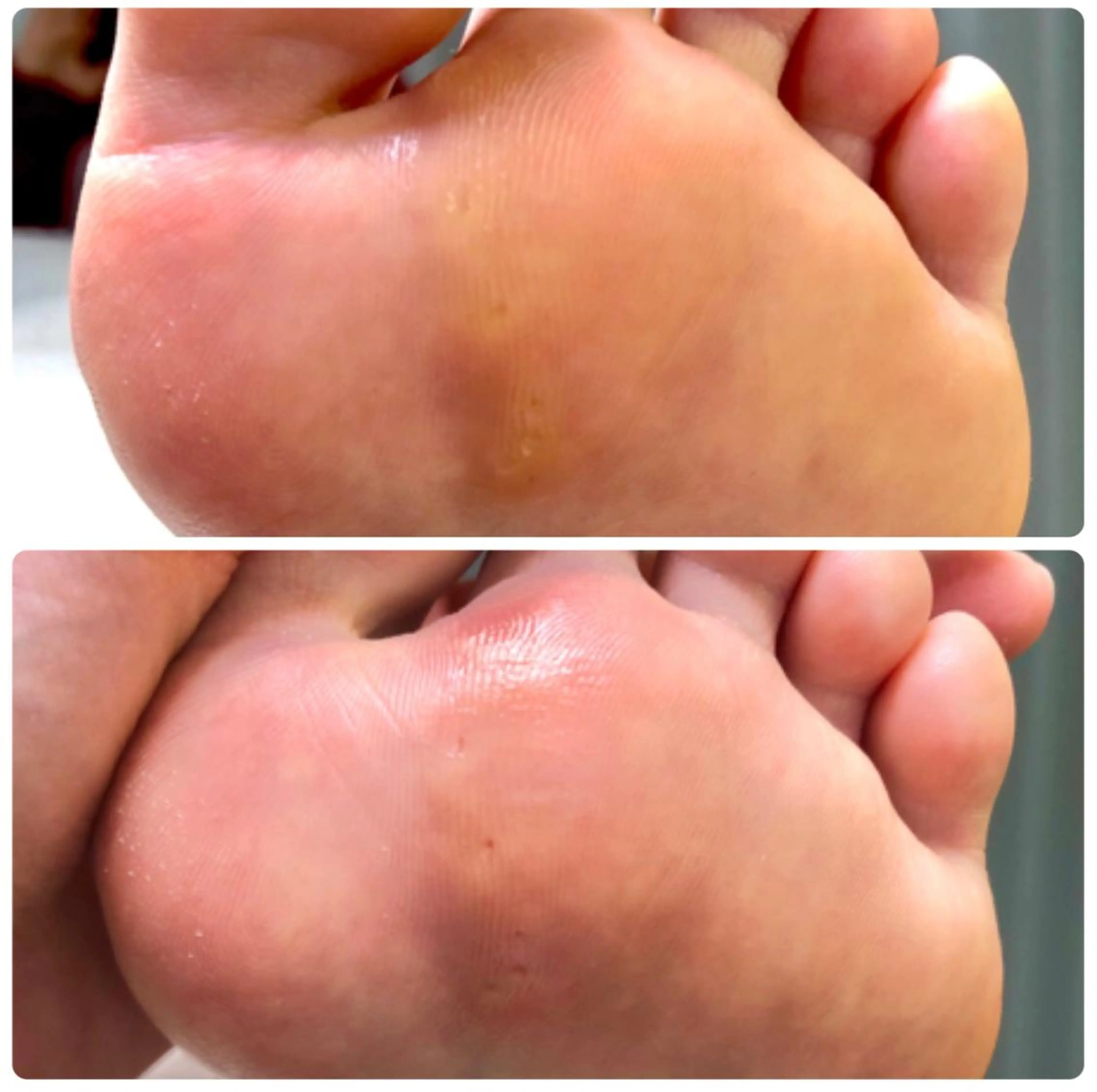 ネイル ⭐️遠藤 夏純⭐️のエステ・リラクイメージ