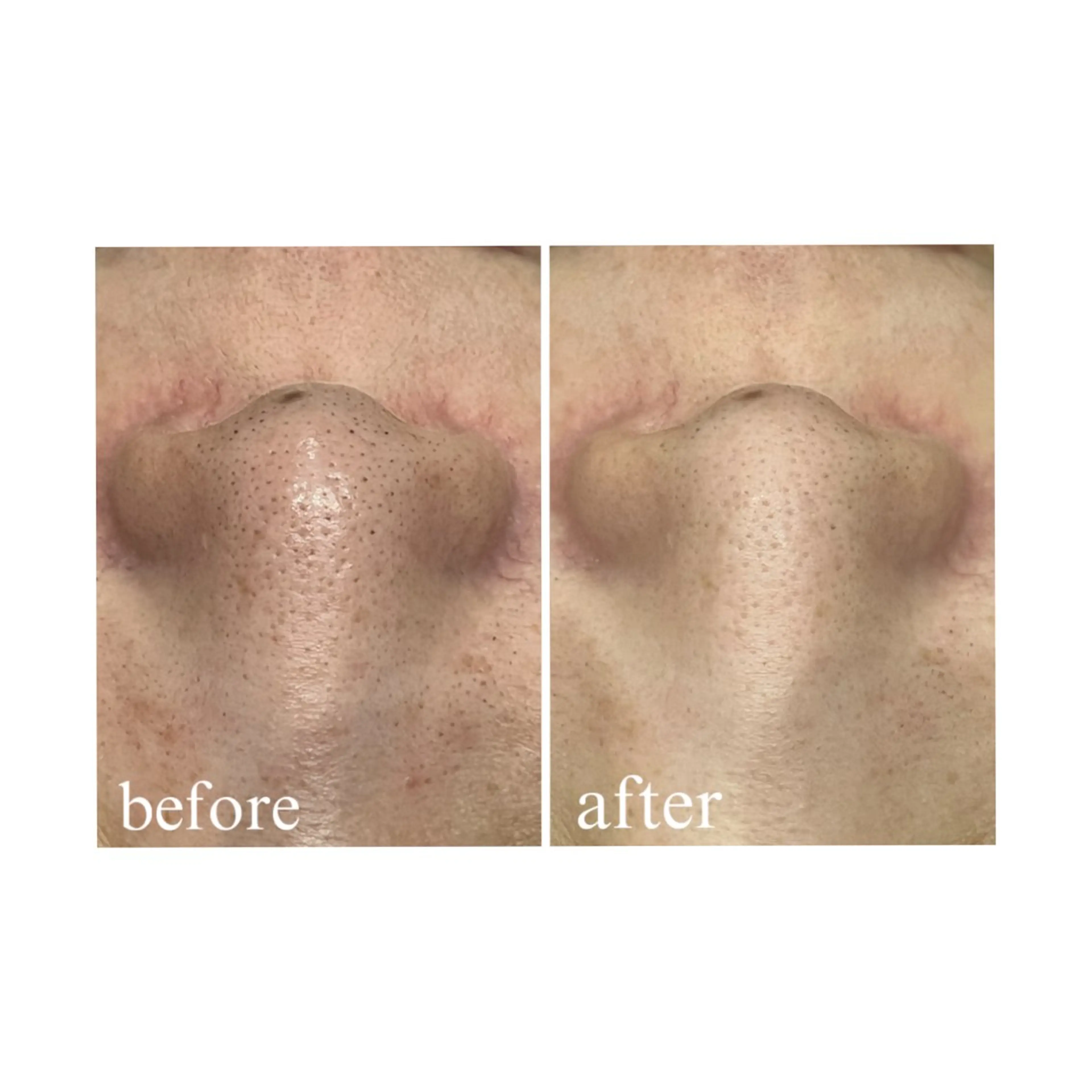 【folche】 フジイのエステ・リラクイメージ