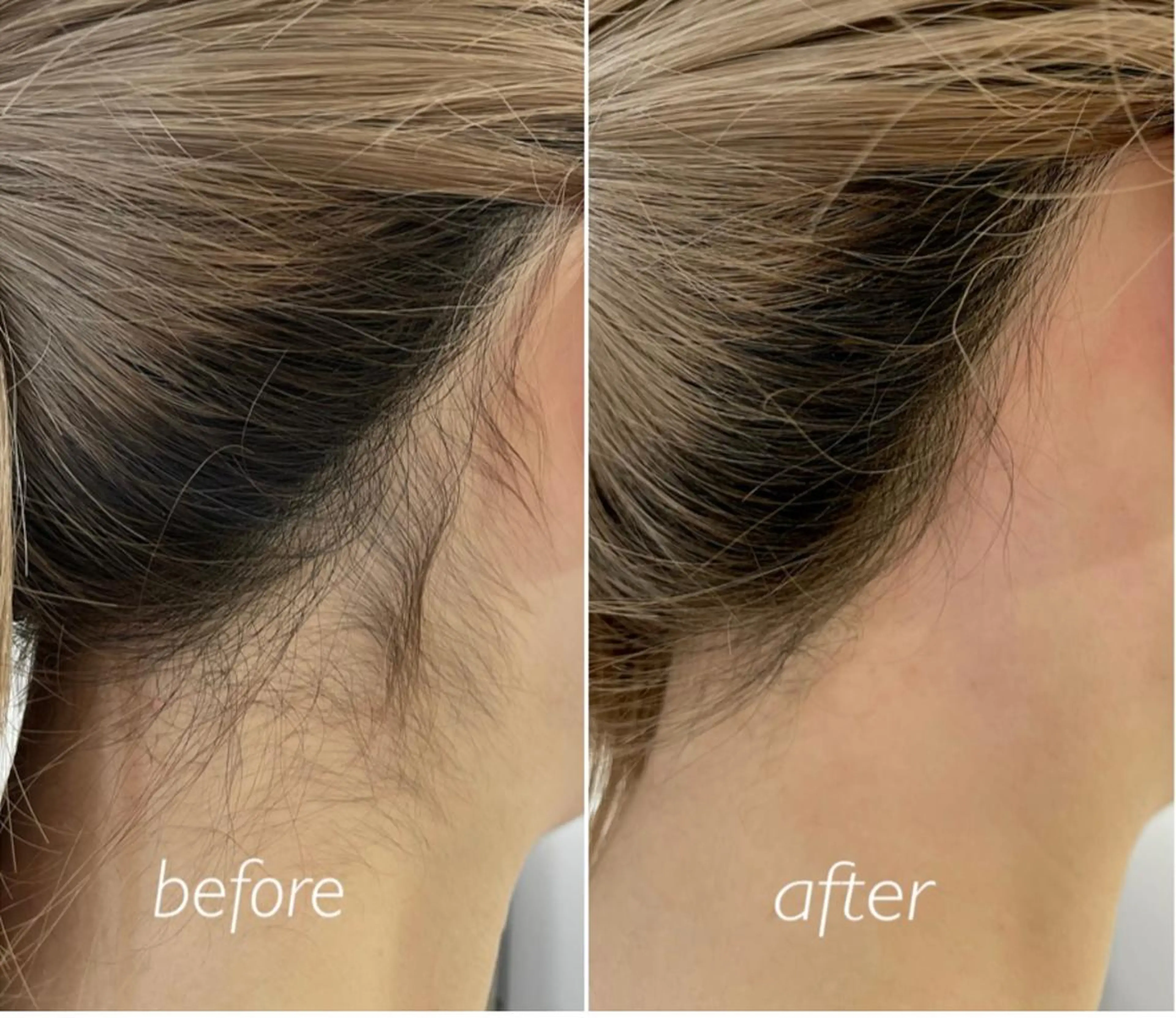 脱毛 ナチュピ所属・シュガーリングサロン ナチュピのエステ・リラクイメージ