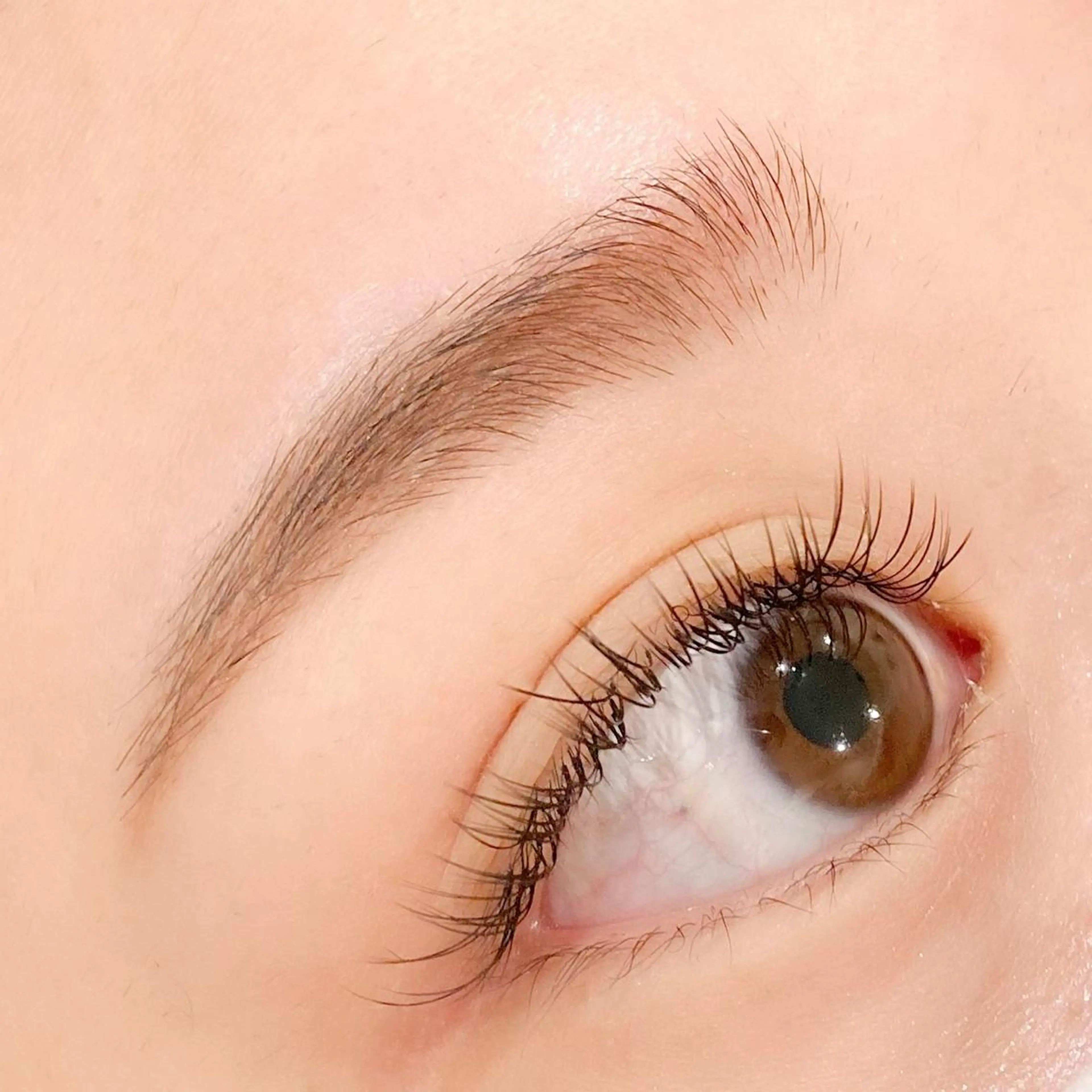 ハーフフェイススレッディング（糸脱毛）眉&額の写真