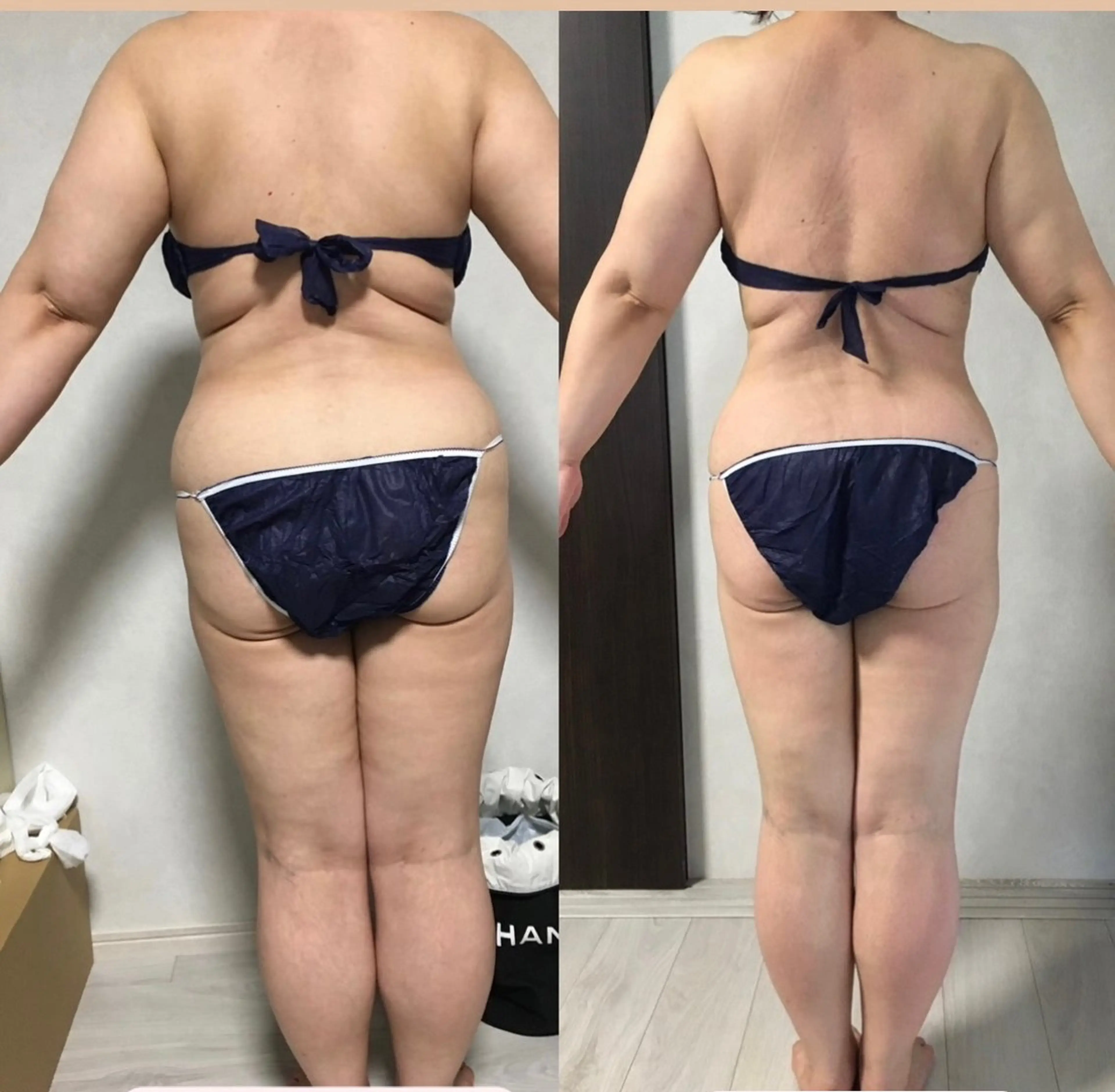 salon de blue rose所属・ハイパーナイフ専門 熊田陽子のエステ・リラクイメージ