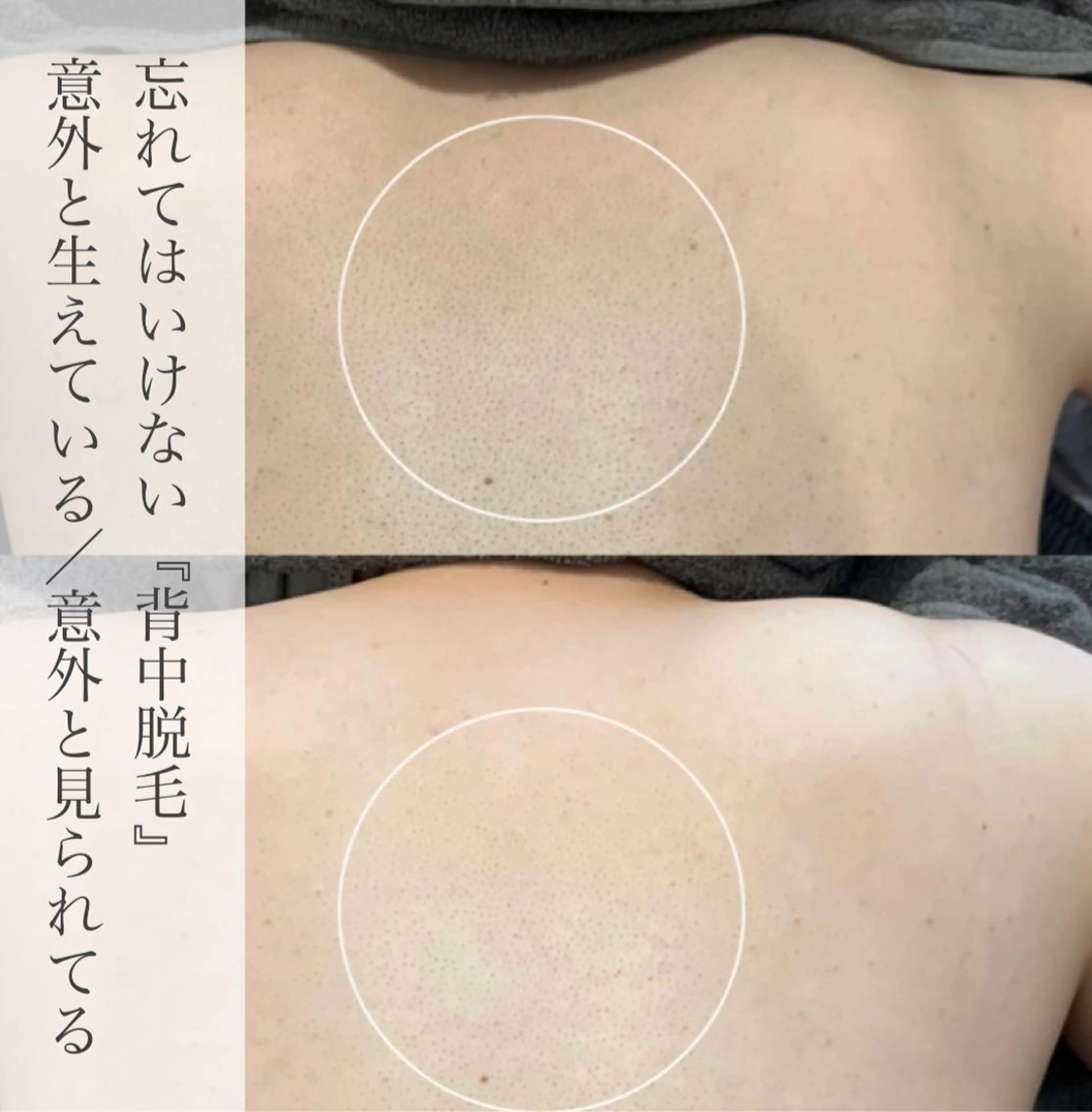 脱毛&ビューティー A'nJUDYの眉毛・アイブロウイメージ