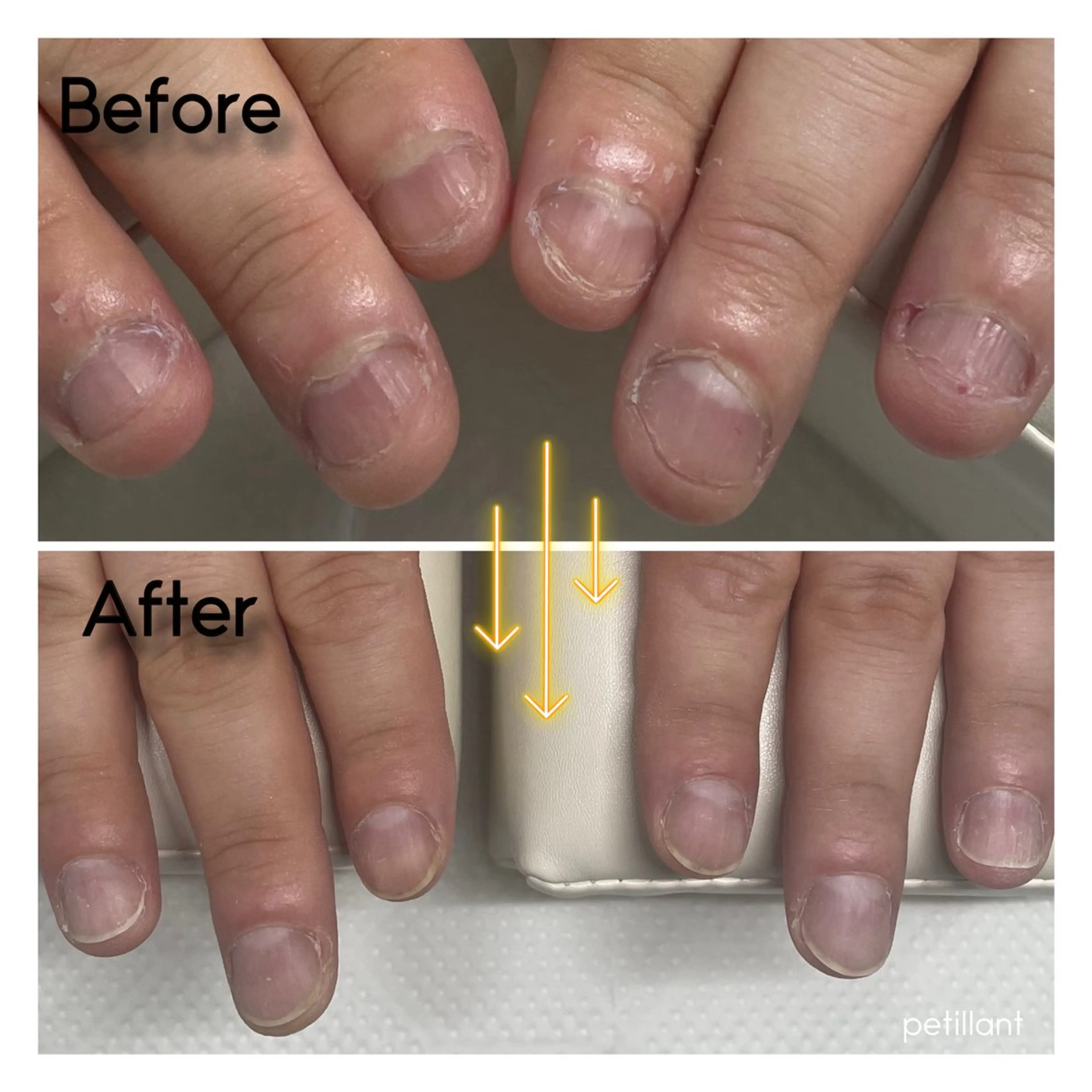 ネイル クリアネイル 長さ出し ジェルネイル マットネイル ハンドネイル ハンドケア petillant所属・nail salon petillantのネイルデザイン