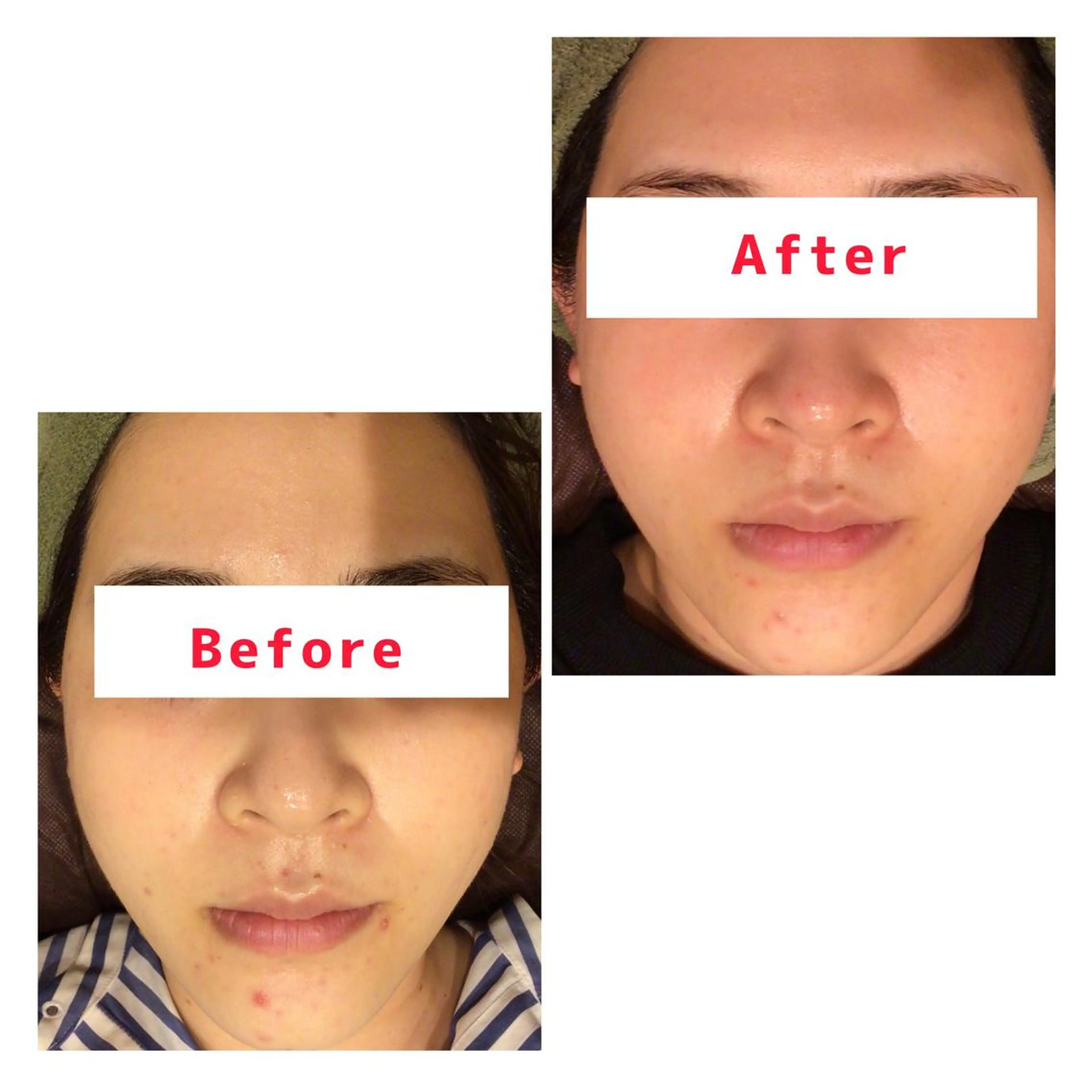 ハーブピーリング専門 muro.のエステ・リラクイメージ