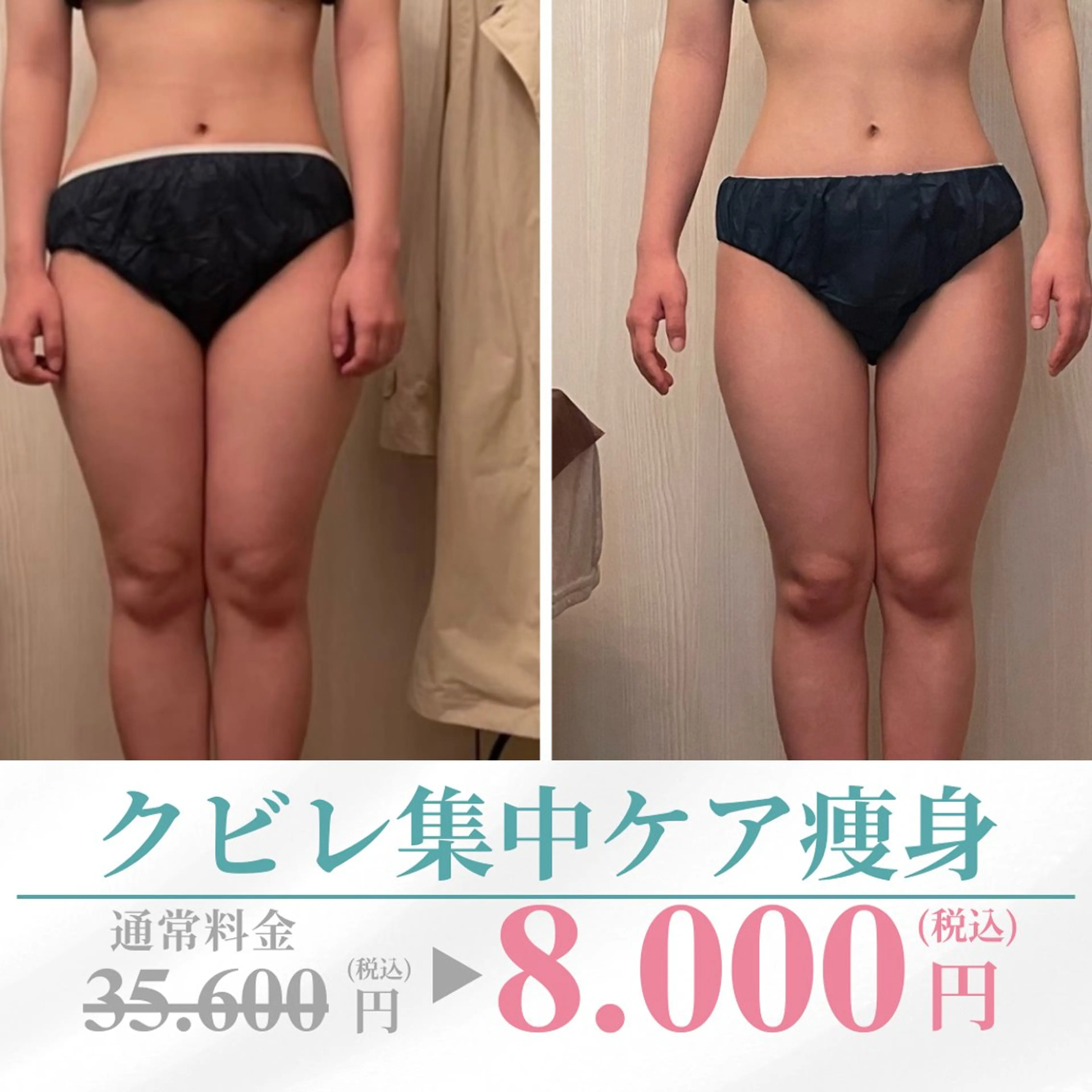 【ウエスト集中90分1回痩身】クビレ復活＆下腹すっきりスリムケアの写真