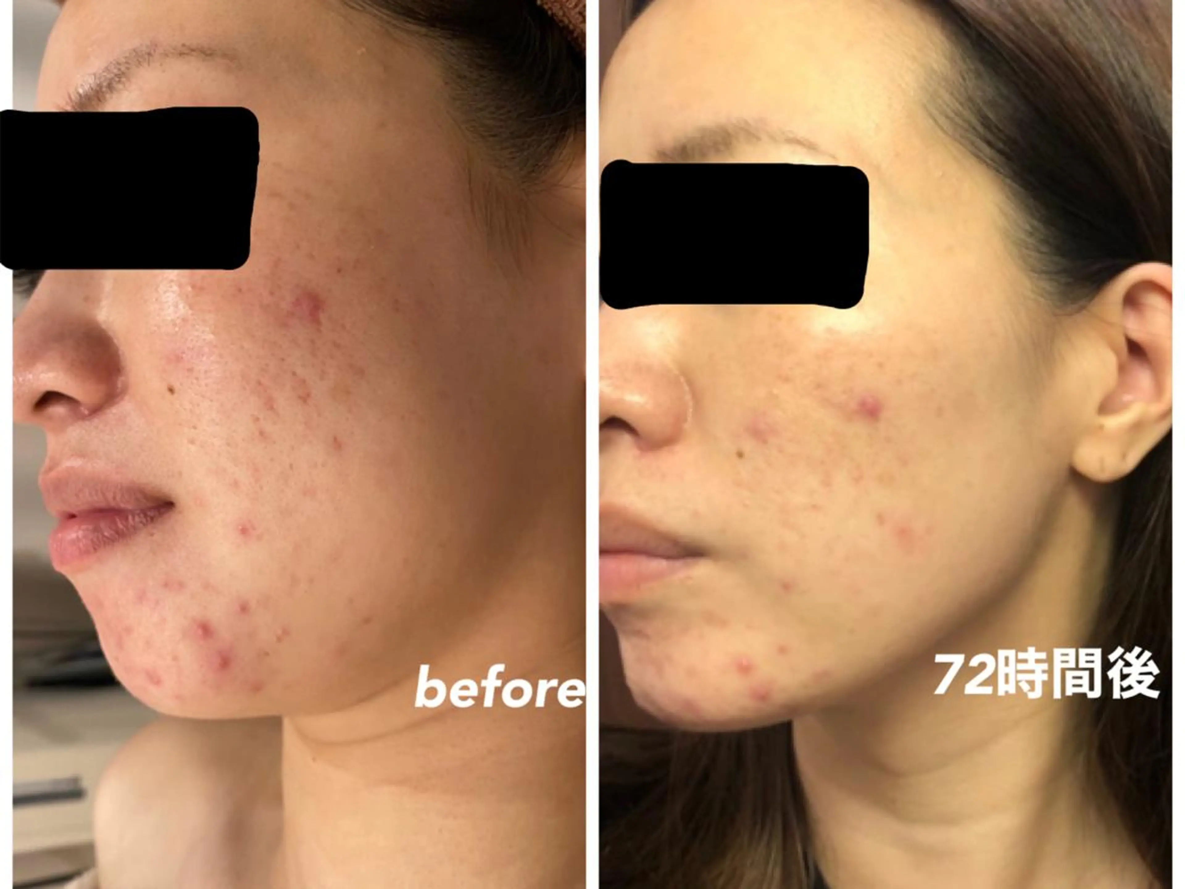 エステ ビューティサロン aiwaのエステ・リラクイメージ