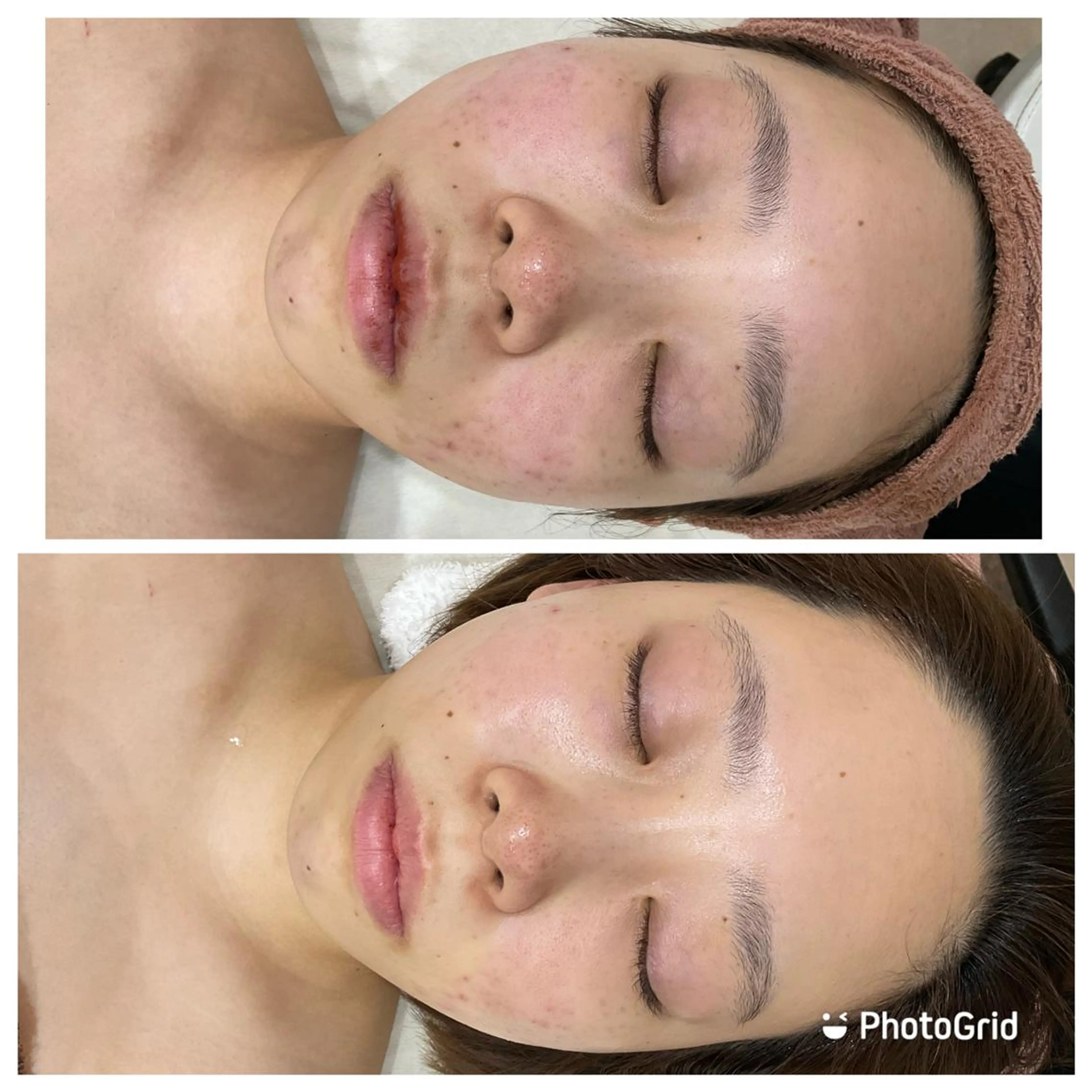 10月限定！夏のダメージ徹底ケア！【毛穴＆小顔＆美白＆肩こり】✨冬に向けて潤いチャージ💚の写真