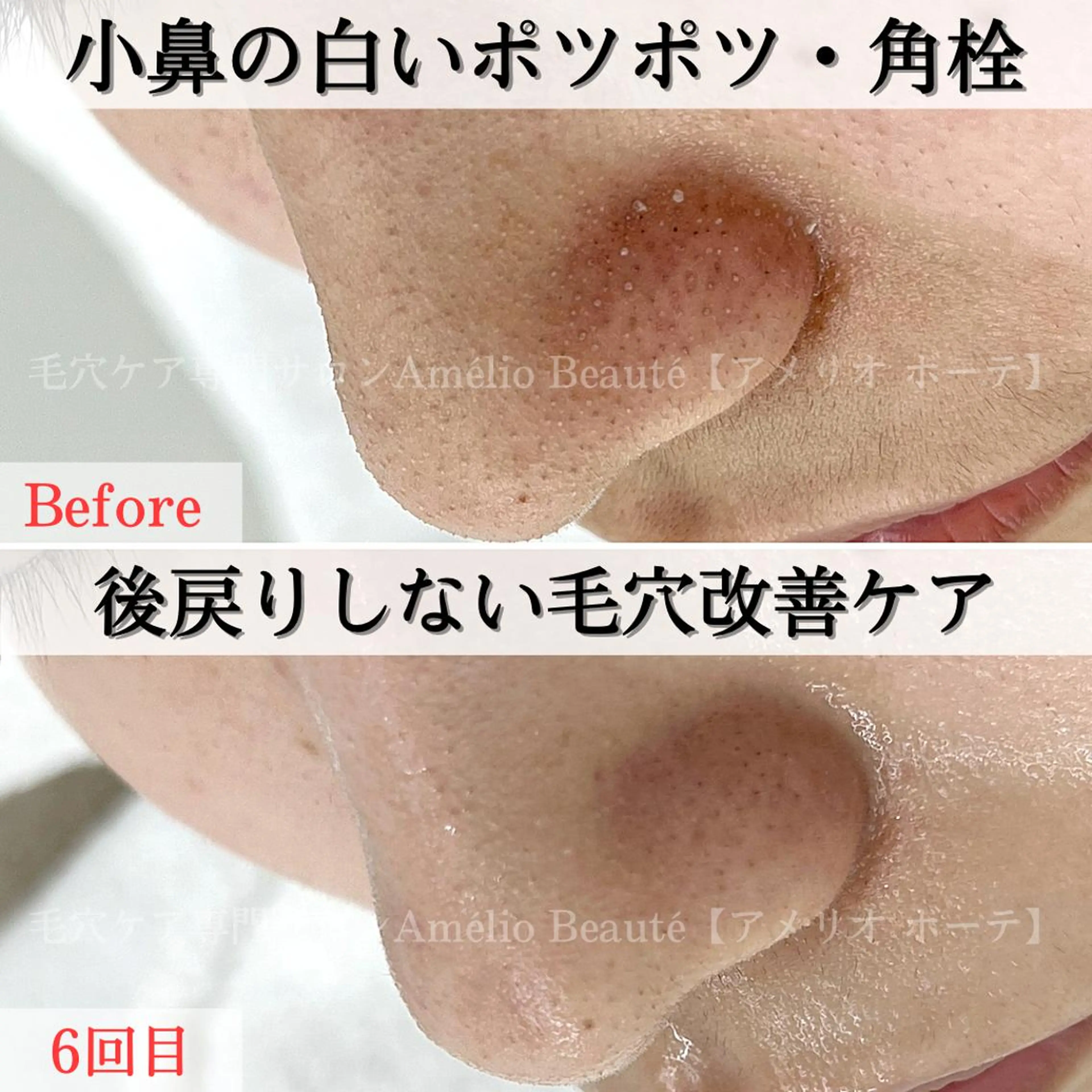 毛穴ケア専門サロン Amélio Beauté所属・毛穴ケア専門サロン アメリオボーテのその他イメージ