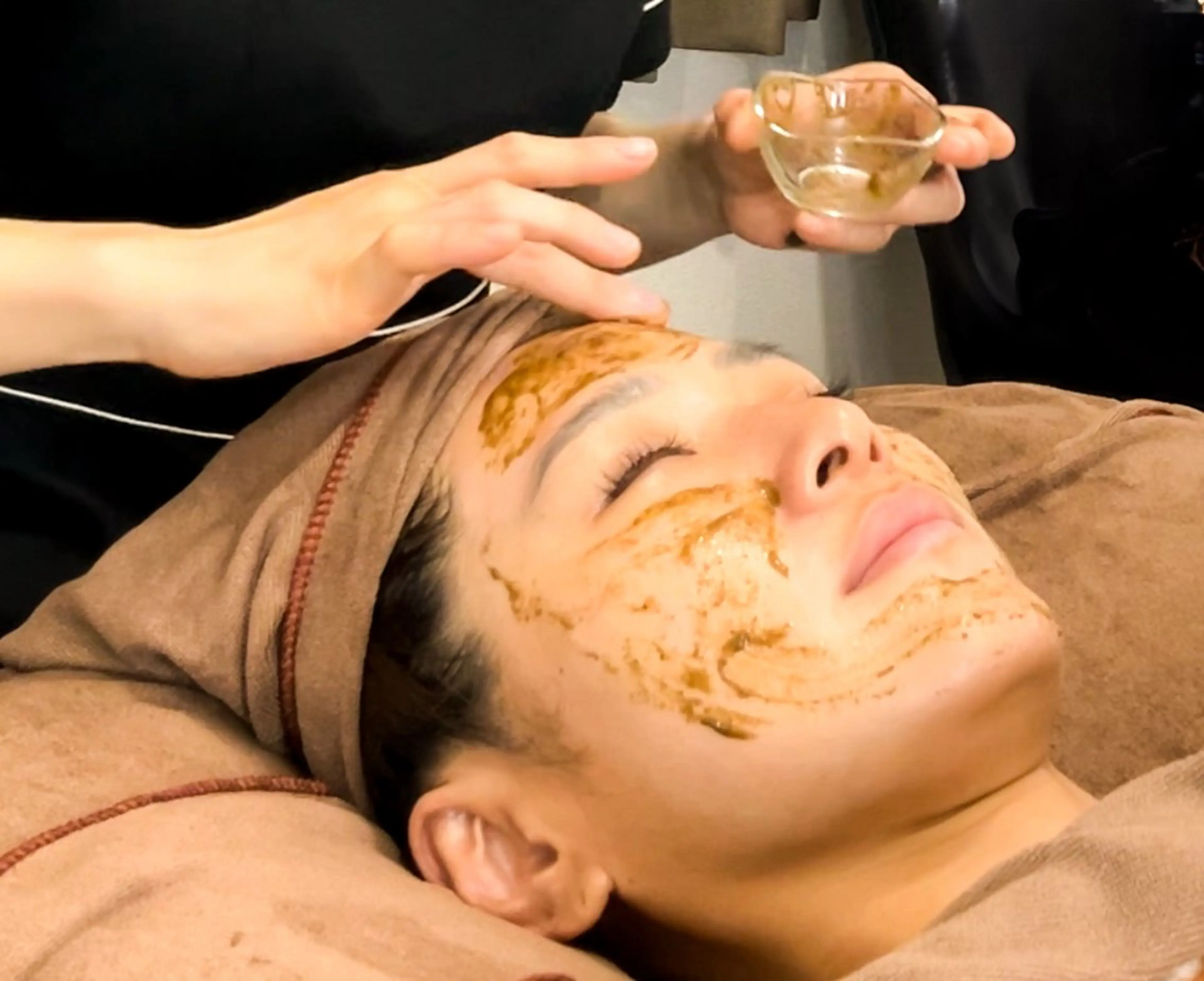 【デコボコ跡ニキビケア✨】繰り返ニキビに❗️キメ細かいツルツル肌へ♪ハーブピーリング🌿の写真