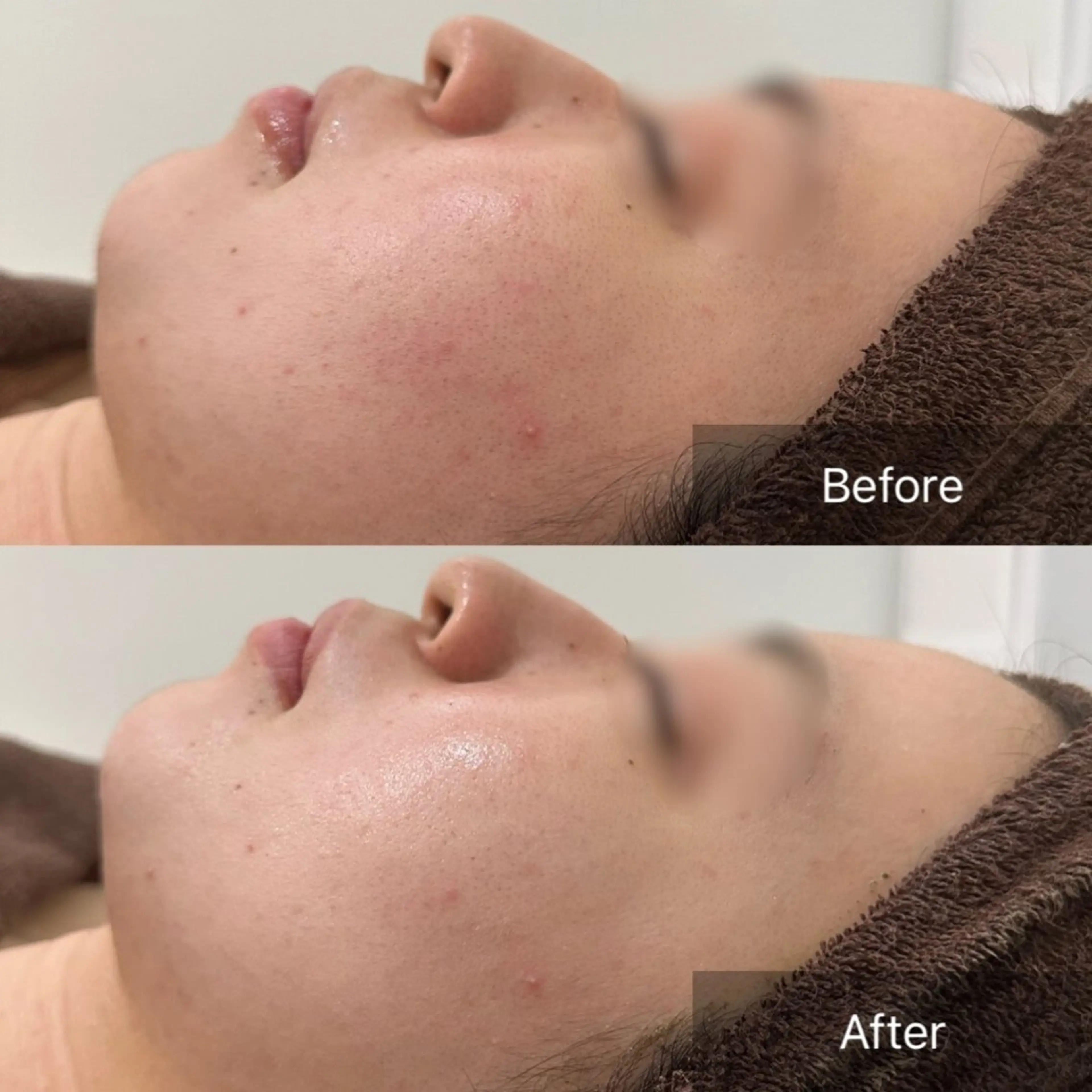 Nicore所属・Nicore NATSUKIのエステ・リラクイメージ