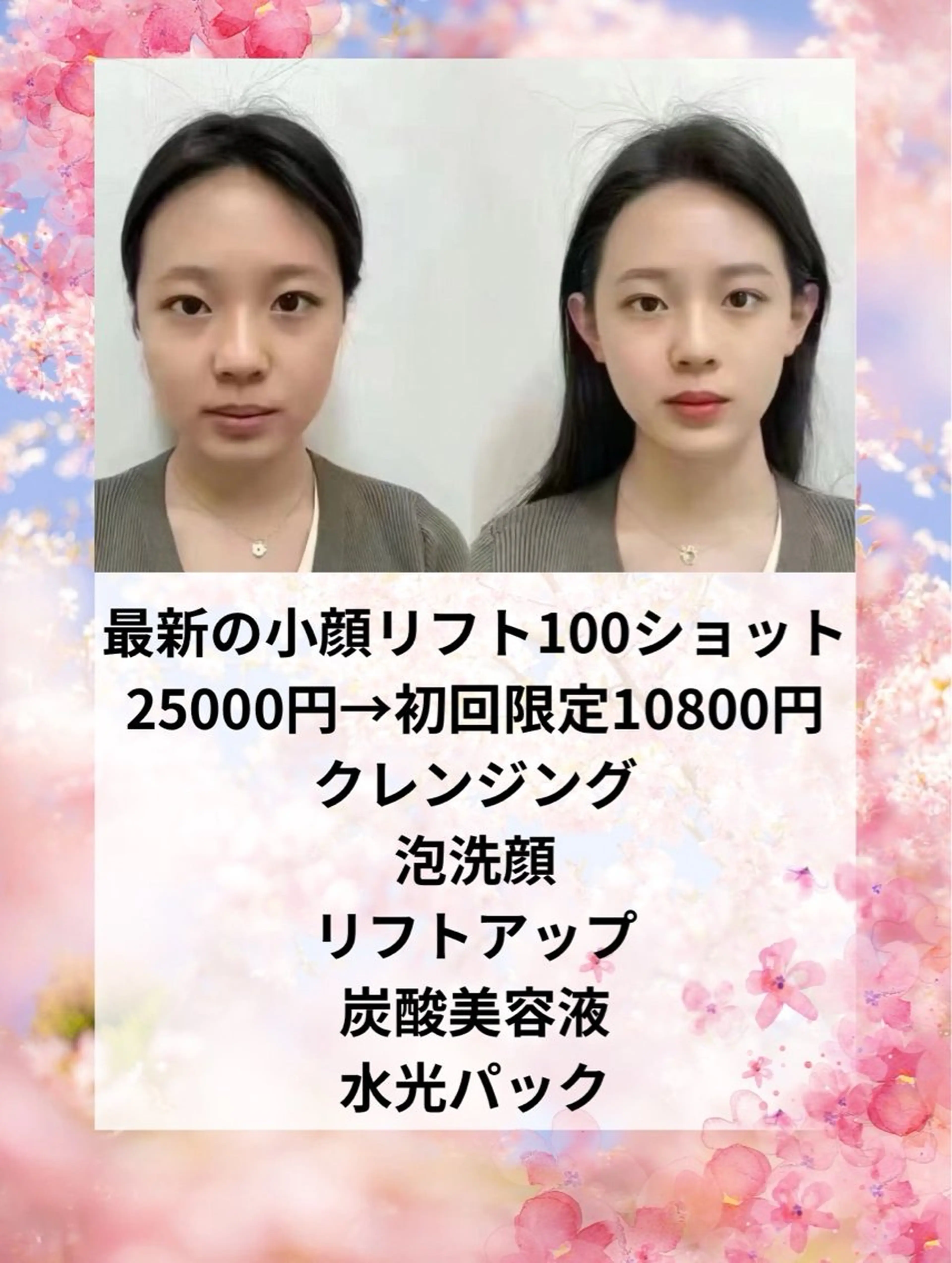 マツエク・マツパ エステ aliaハイフ&水光ジェットサロン所属・aliaハーブ水光店 エステティシャン募集のエステ・リラクイメージ