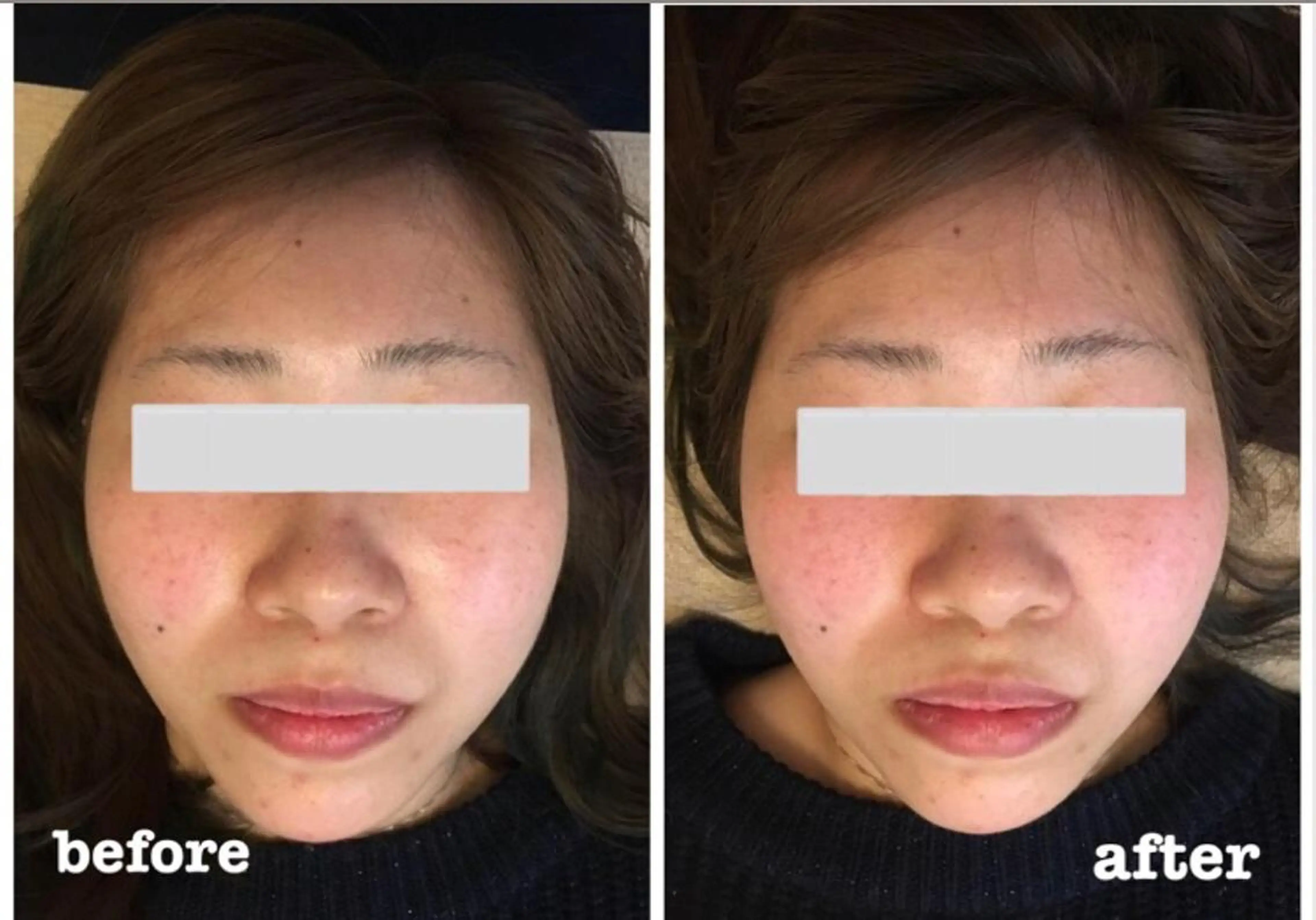 エステ リラク 佐々木 唯のエステ・リラクイメージ