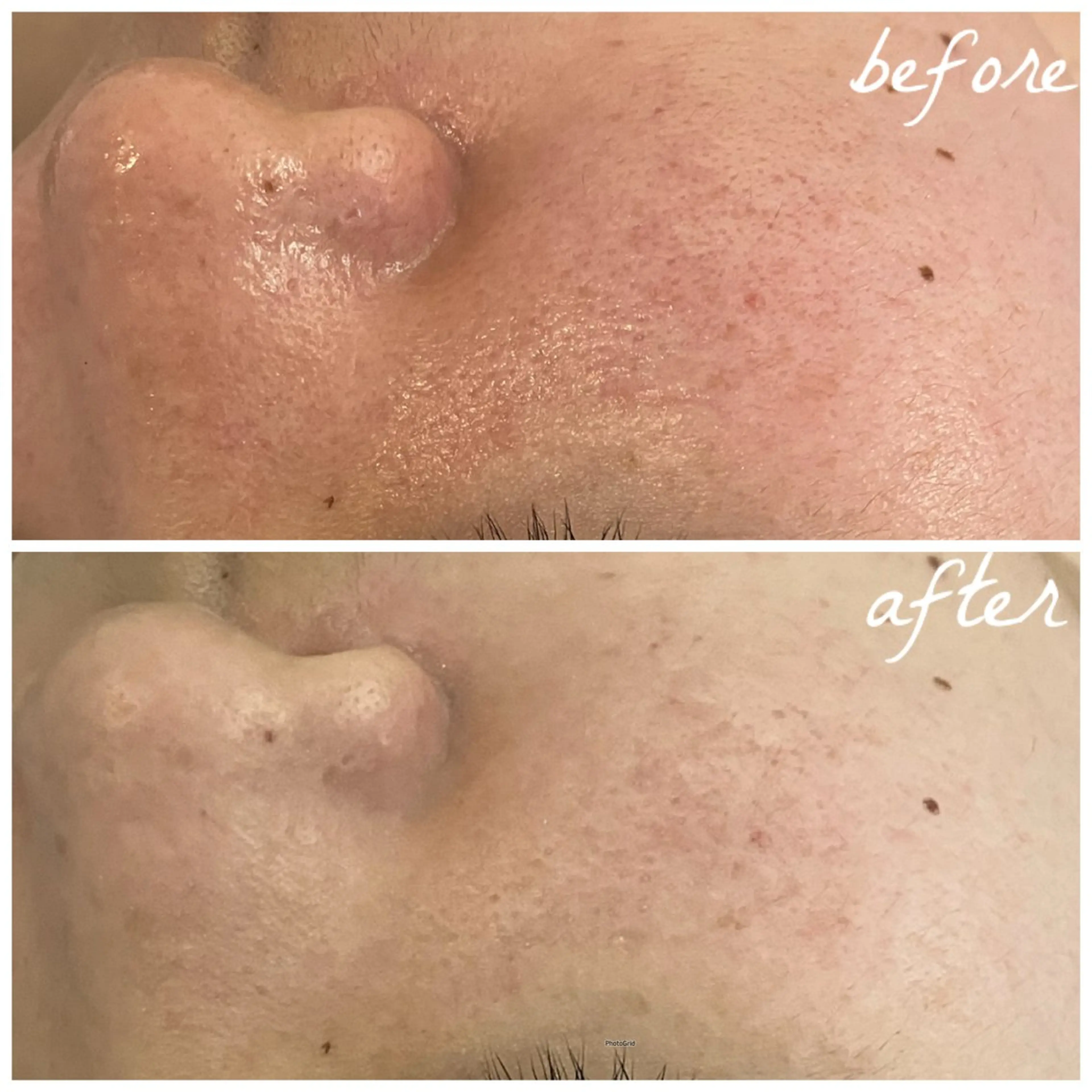 メンズ メナード岐阜茜部 杉浦のエステ・リラクイメージ