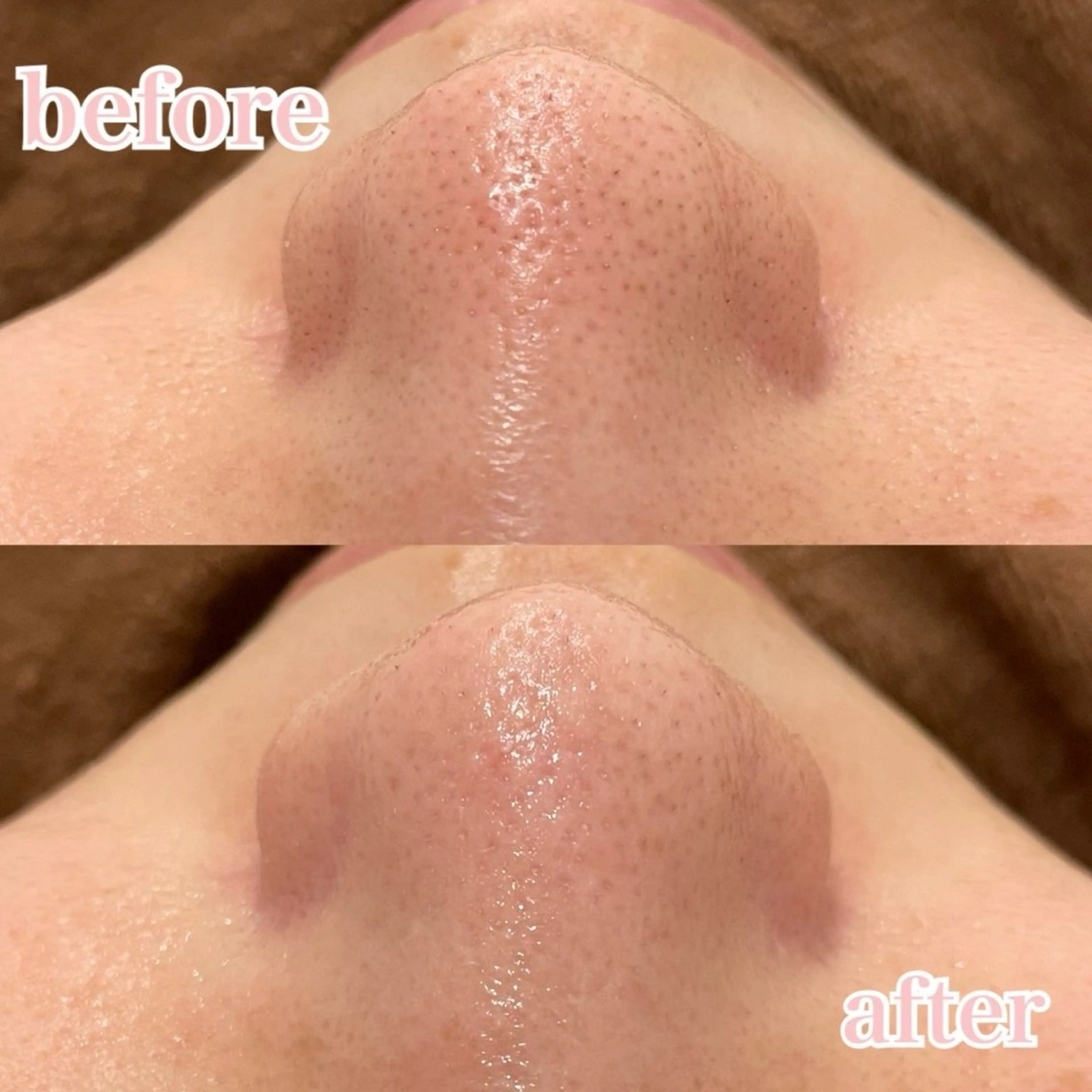 肌管理専門店Whitelabo堺東店所属・おだ あみのエステ・リラクイメージ