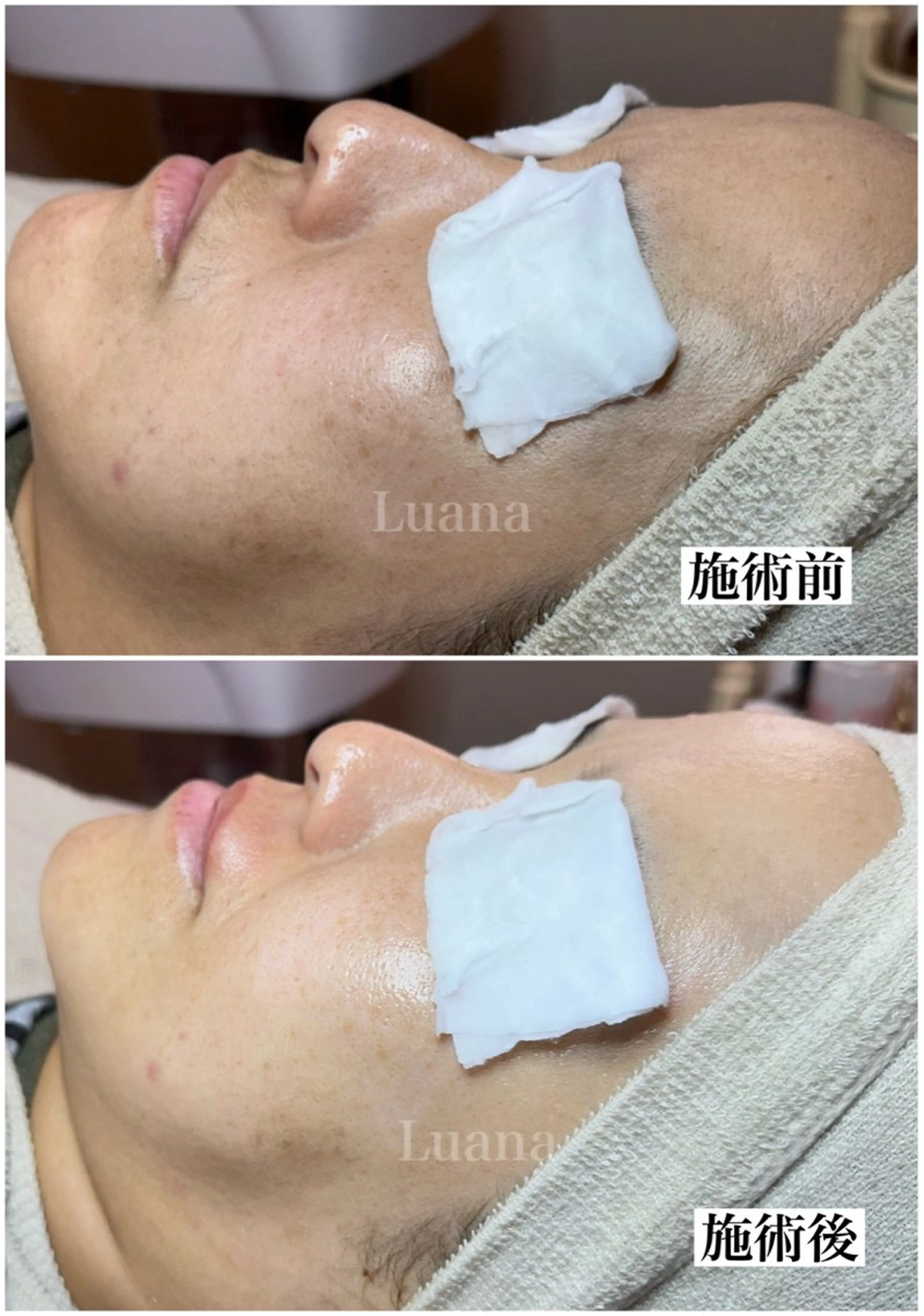 マツヤニWax専門/ 岸和田/Luanaのエステ・リラクイメージ