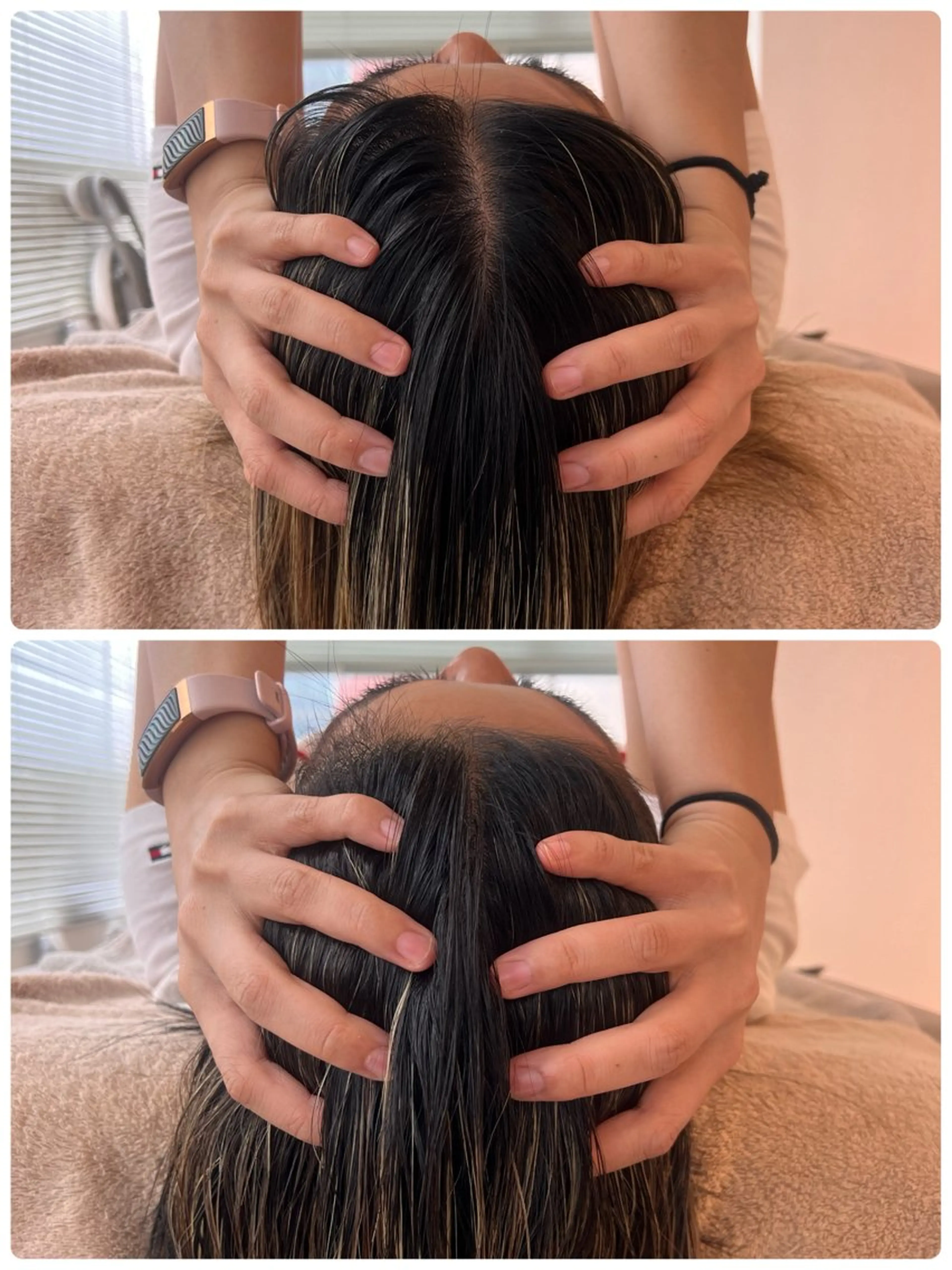 エイジングヘッドスパの写真