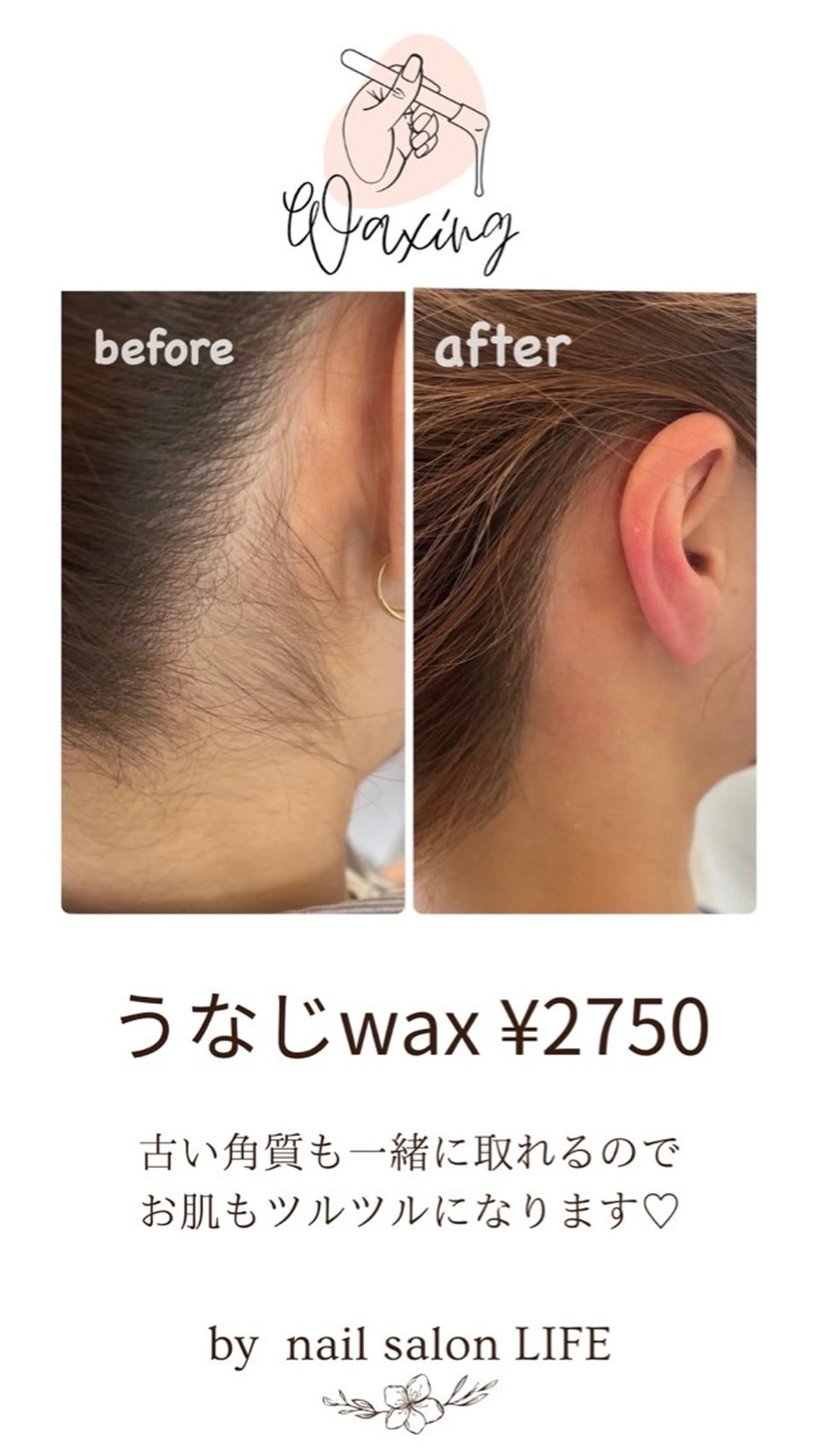 うなじwaxの写真