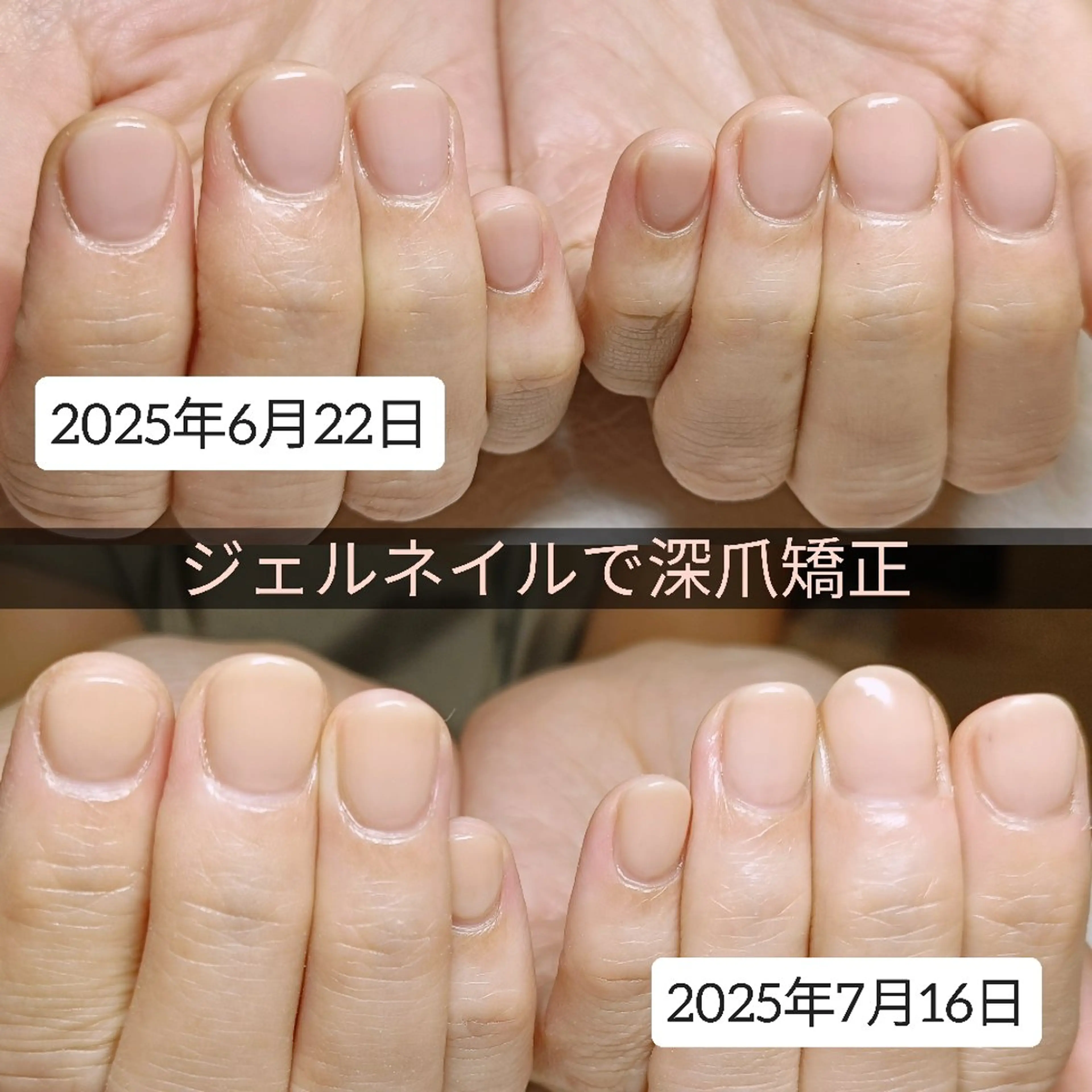 ネイル ハンドネイル ハンドケア 深爪矯正/爪育成ケア manie nailのネイルデザイン