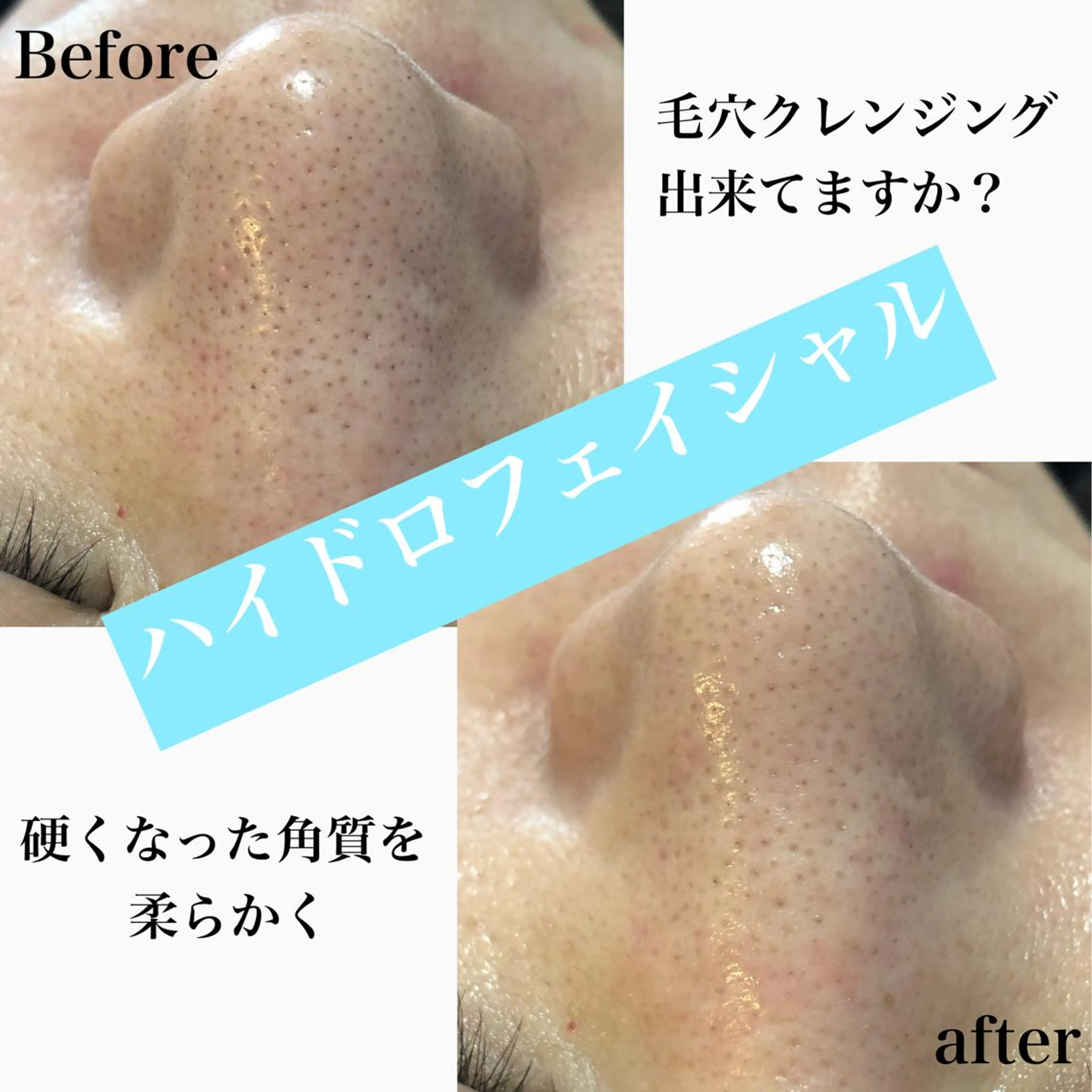 エステ 美肌脱毛と癒しのﾌﾟﾗｲﾍﾞｰﾄｻﾛﾝ。gratia~ｸﾞﾚｲﾃｨｱ~所属・gratia ~ｸﾞﾚｲﾃｨｱ~のエステ・リラクイメージ