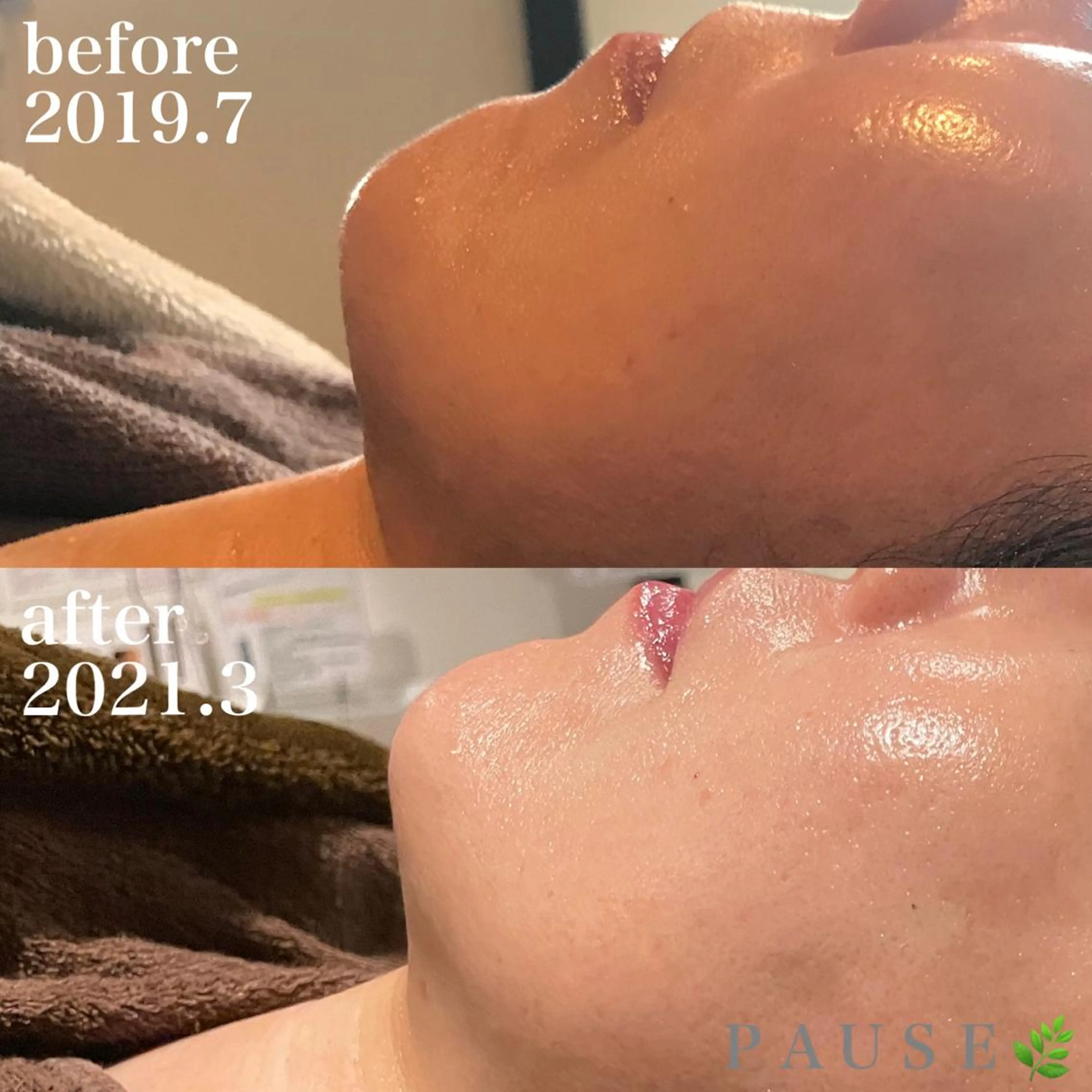 エステ 浜野 恵美のエステ・リラクイメージ