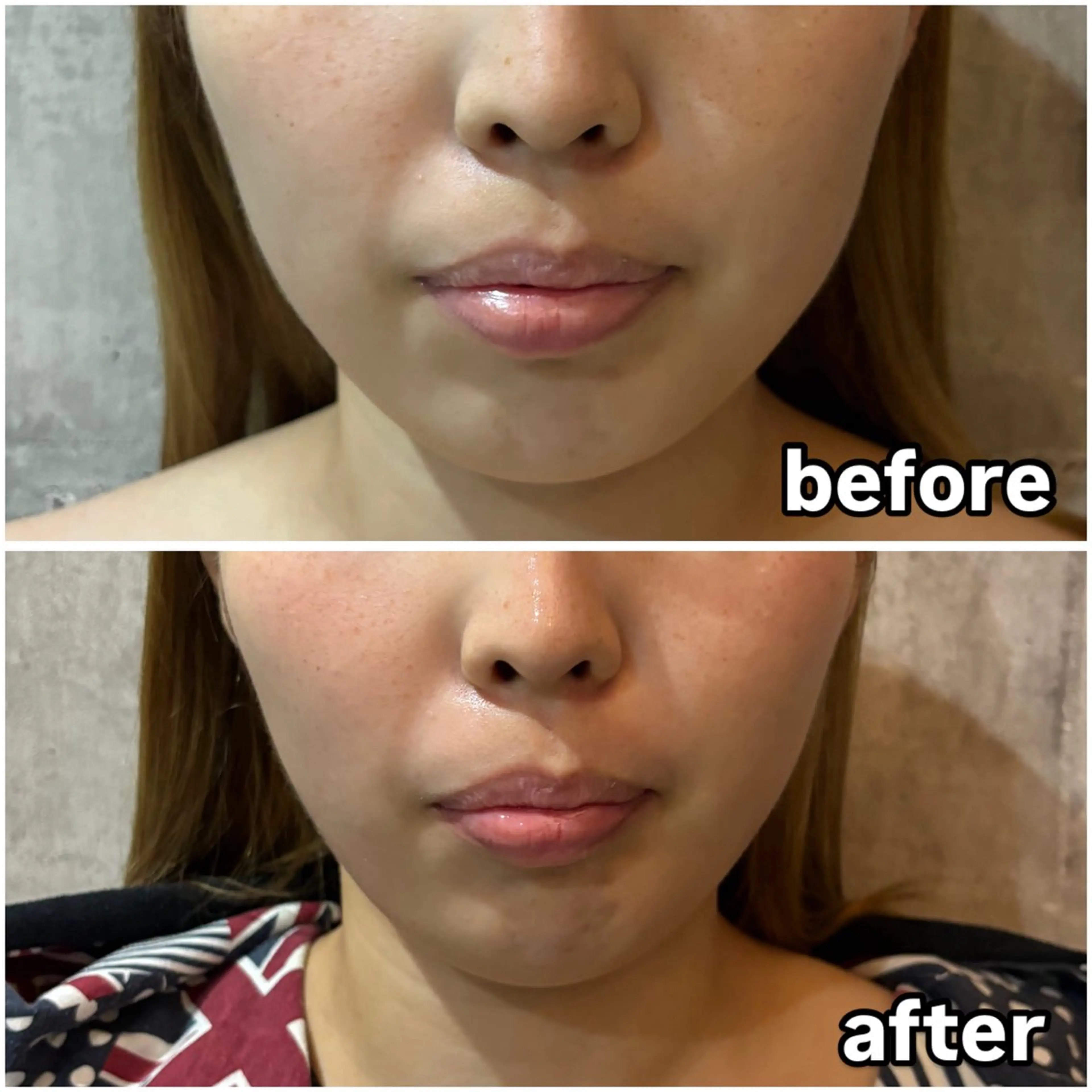 Men's Nail Vitip所属・sekiyama junnaのエステ・リラクイメージ