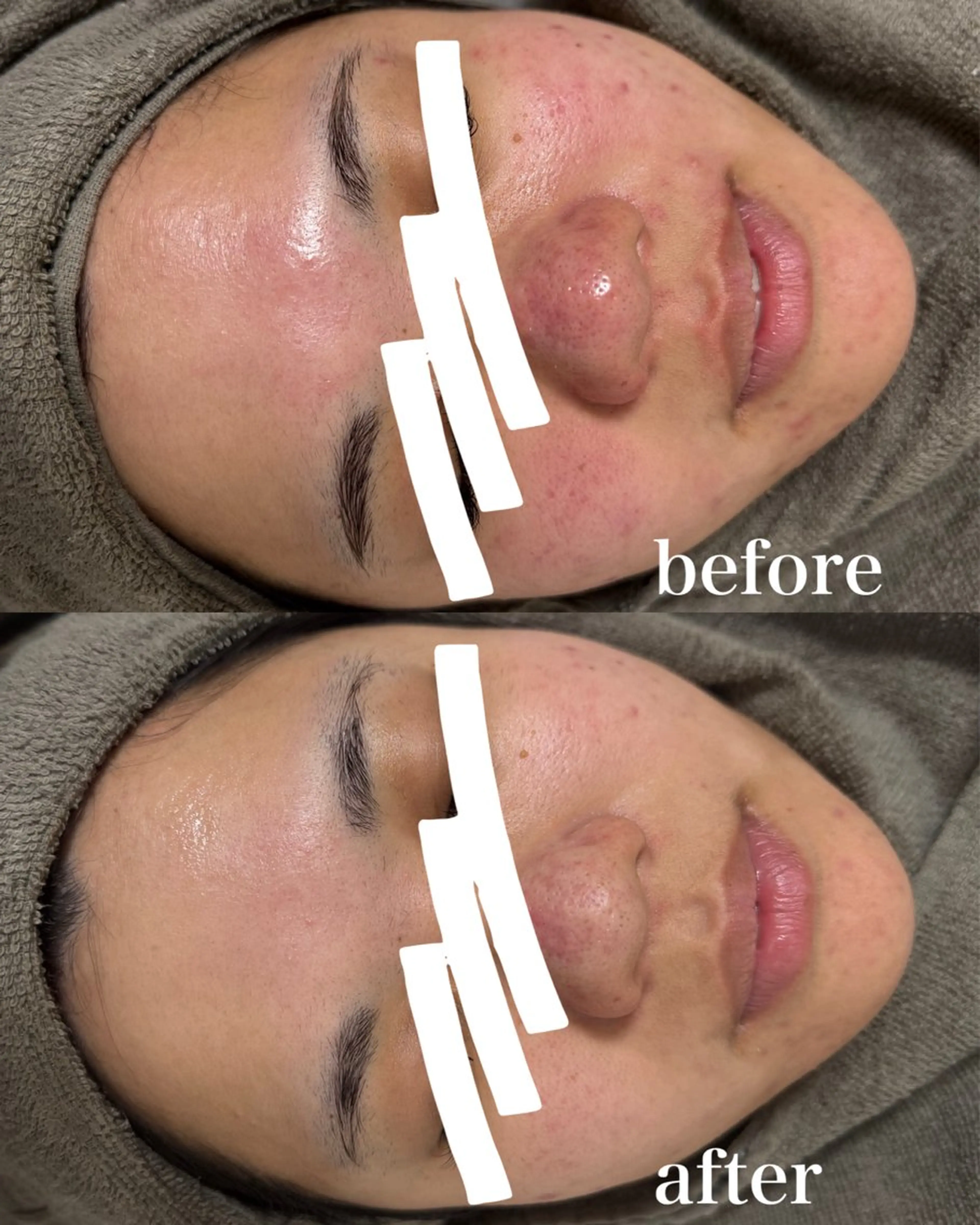 ハーブピーリング専門店lume(ルーム)所属・瀧野 史園のエステ・リラクイメージ