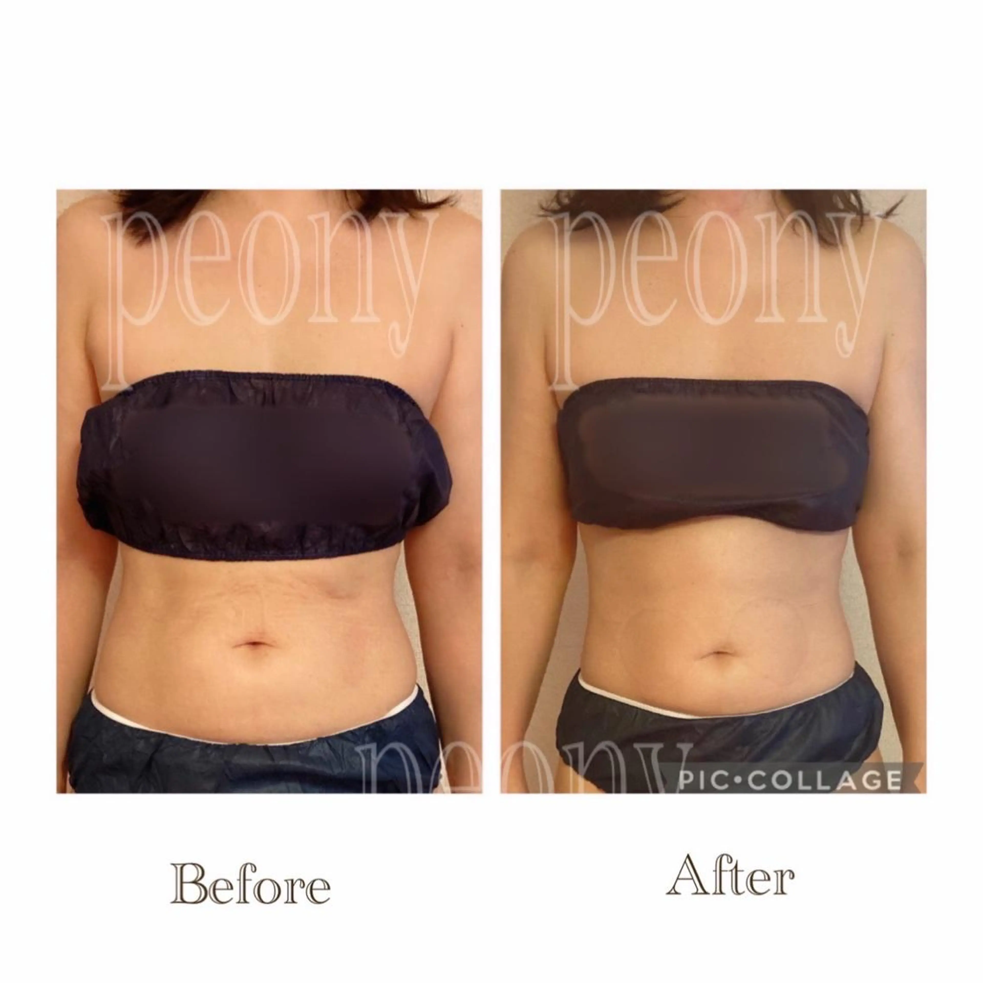 エステ デトックス美容専門サロンｐｅｏｎｙ所属・デトックス美容専門 サロンｐｅｏｎｙのエステ・リラクイメージ