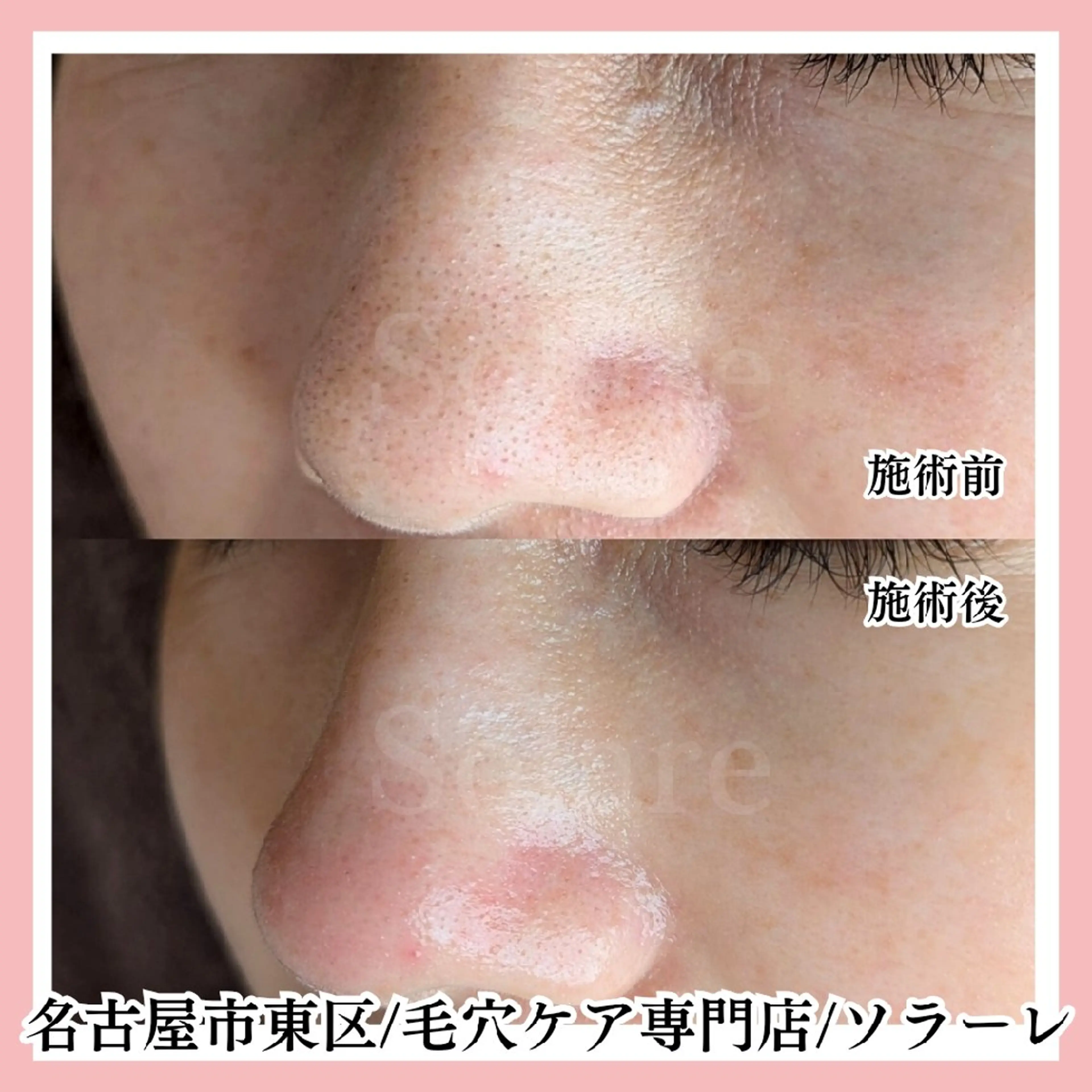 エステ リラク  毛穴洗浄・まつ毛 の専門店 ソラーレのエステ・リラクイメージ