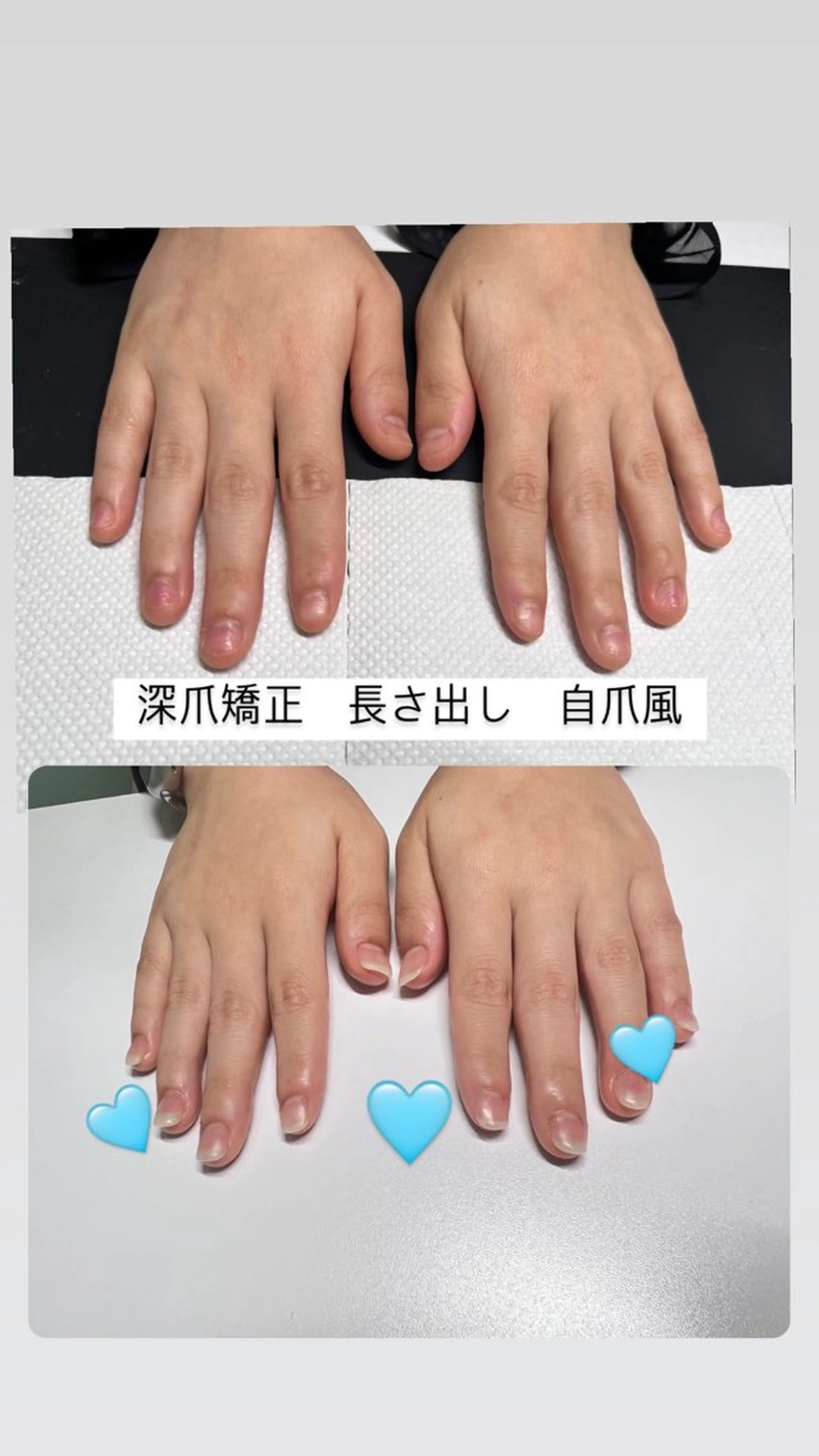 メンズ ネイル 爪ケア/深爪 自爪育成 🐰えむのネイルデザイン