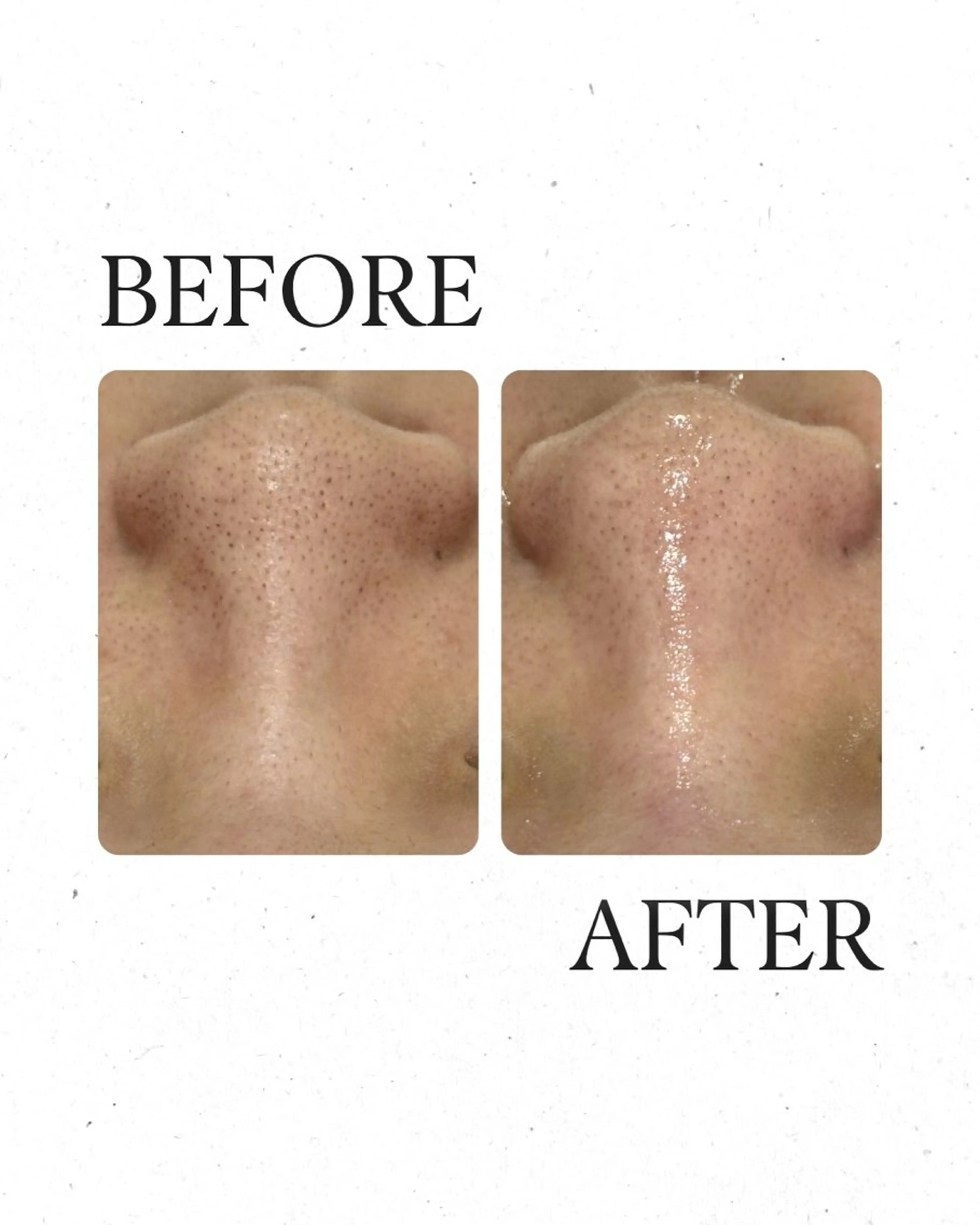 エステ AY'S所属・倉敷/玉島/20代 からの大人毛穴洗浄のエステ・リラクイメージ