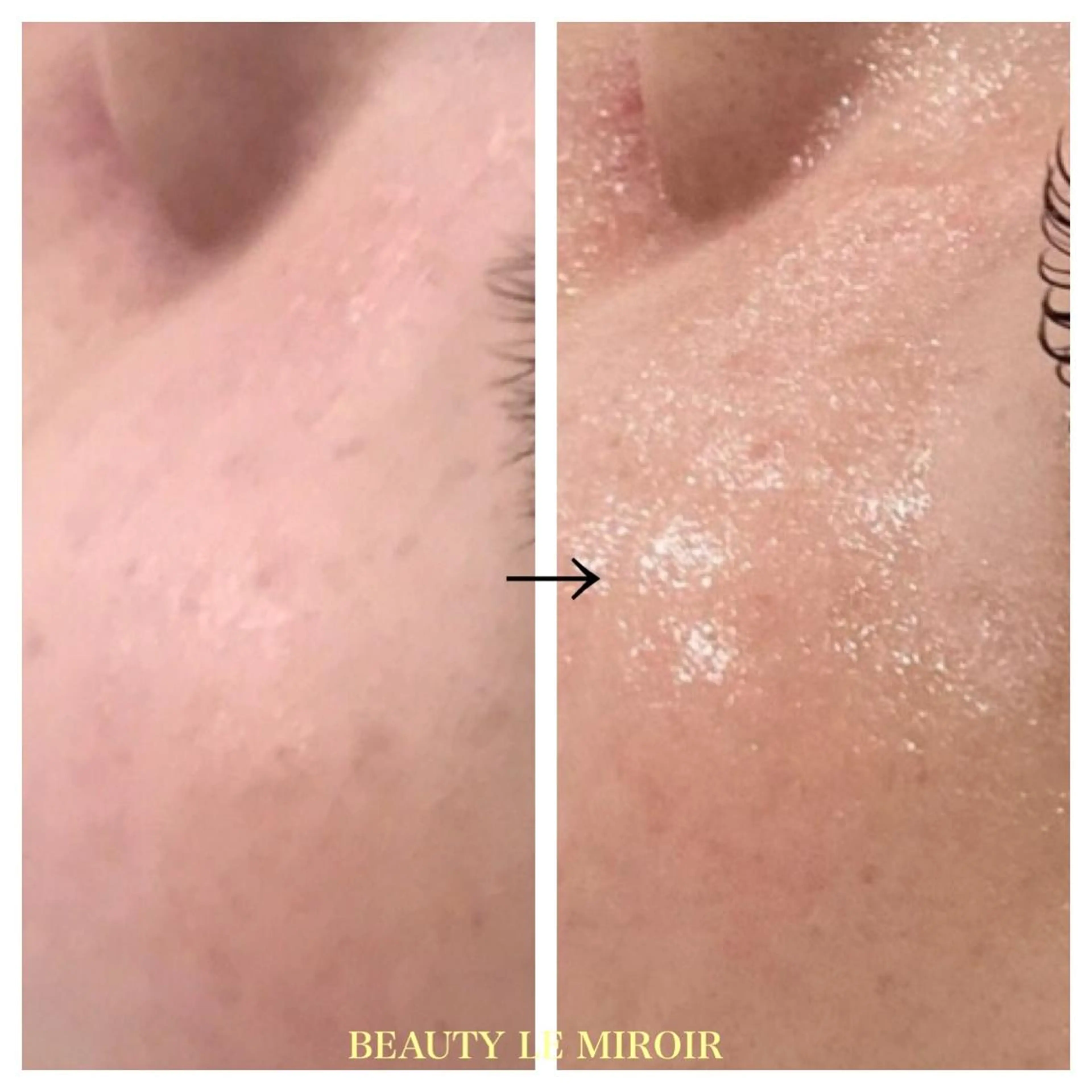 ビューティー ミロワールのエステ・リラクイメージ