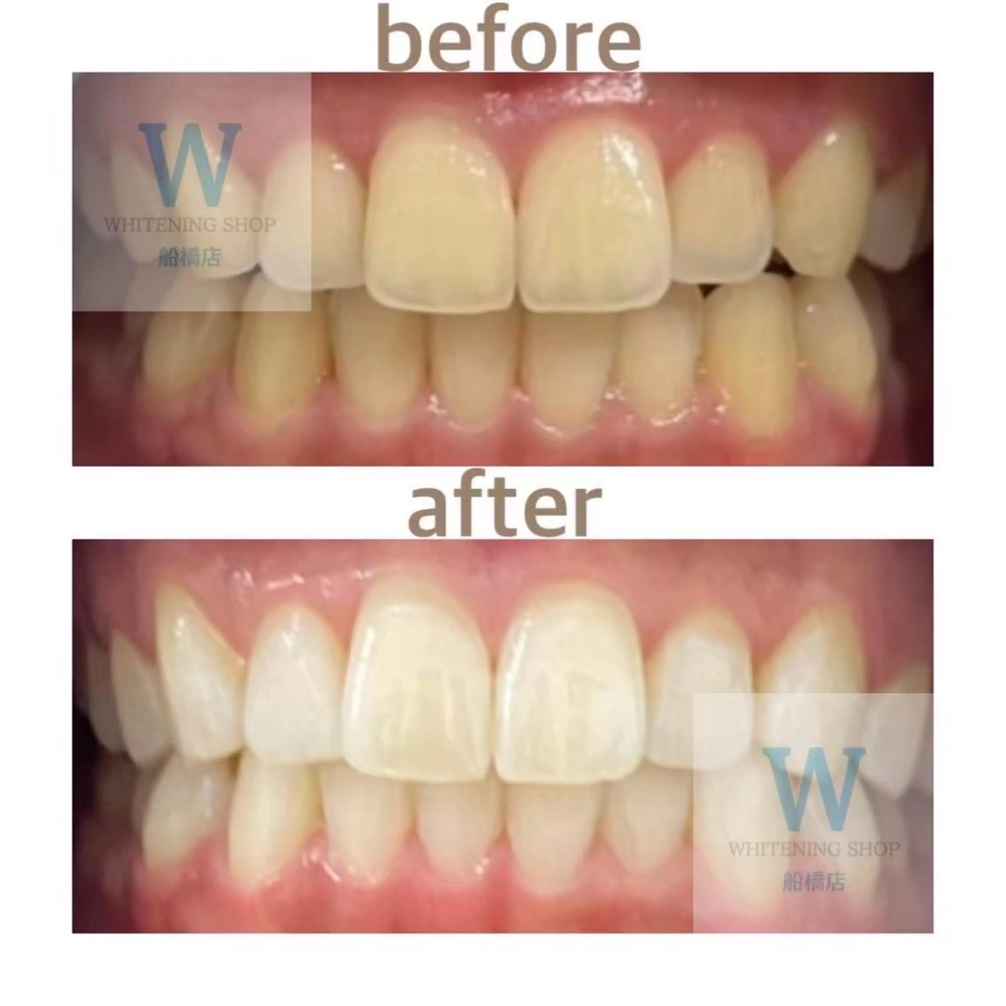 エステ リラク ホワイトニング ショップ船橋店🦷のエステ・リラクイメージ