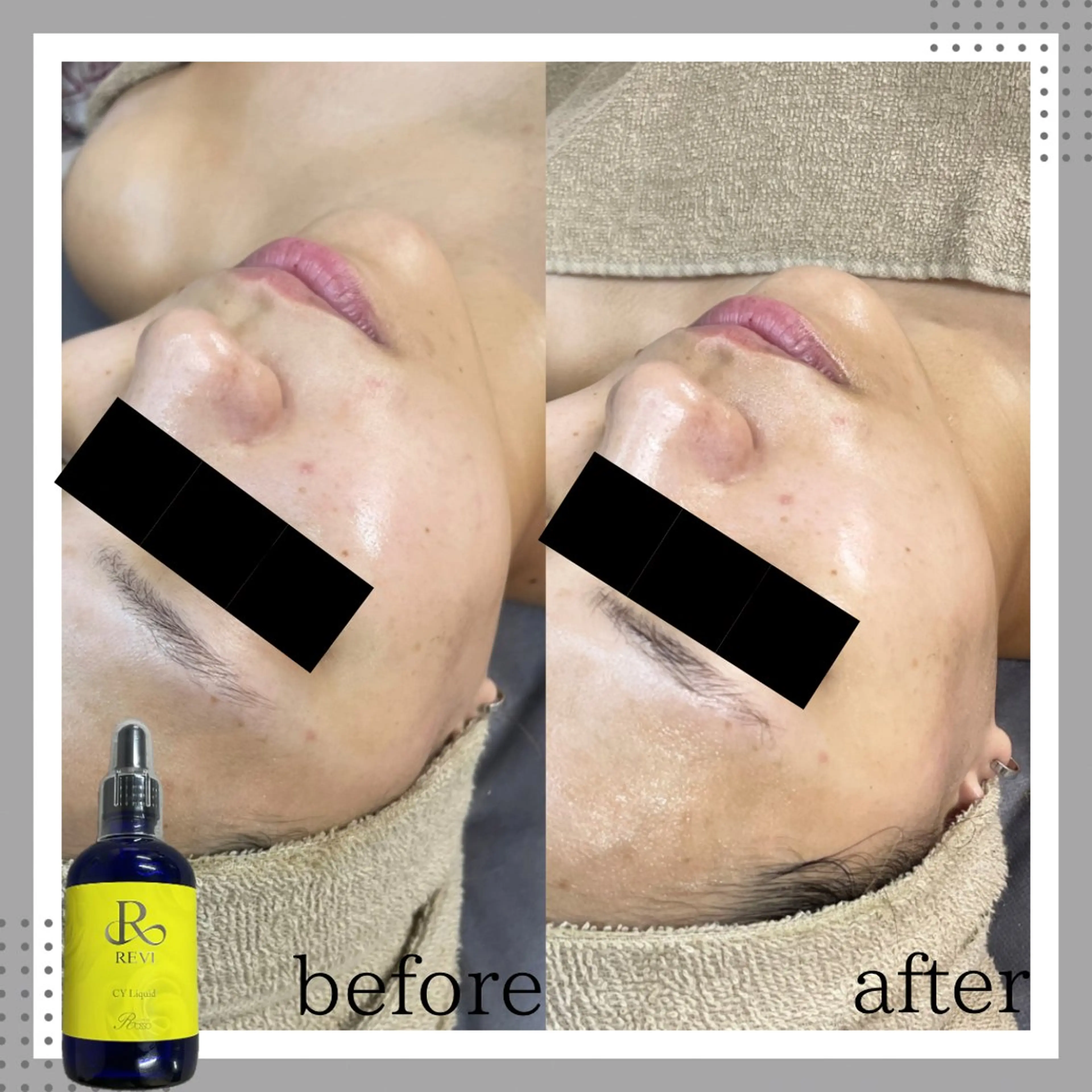 エステ amber(アンバー)所属・プライベートサロン amberのエステ・リラクイメージ