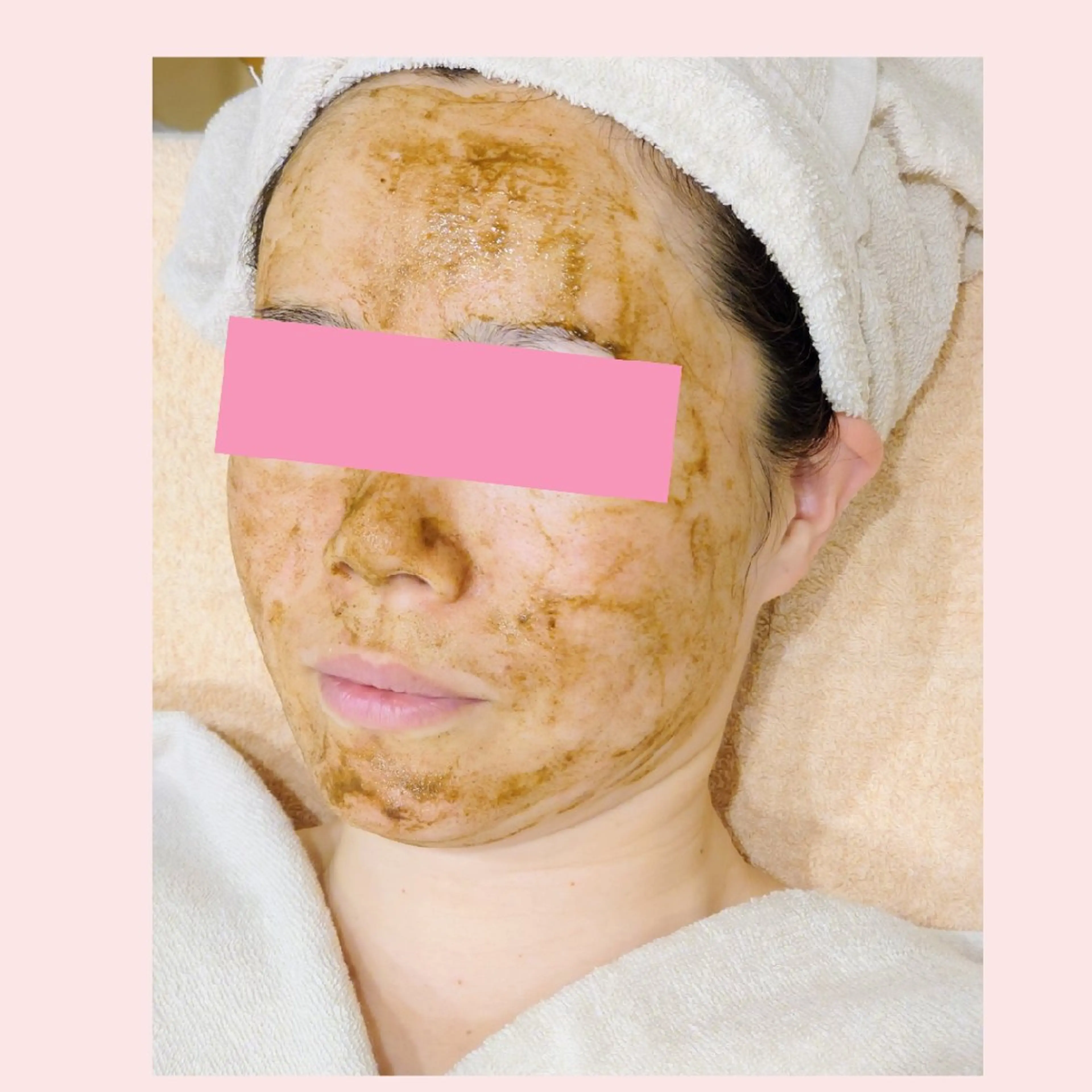 ハーブピーリングFacial 75分の写真