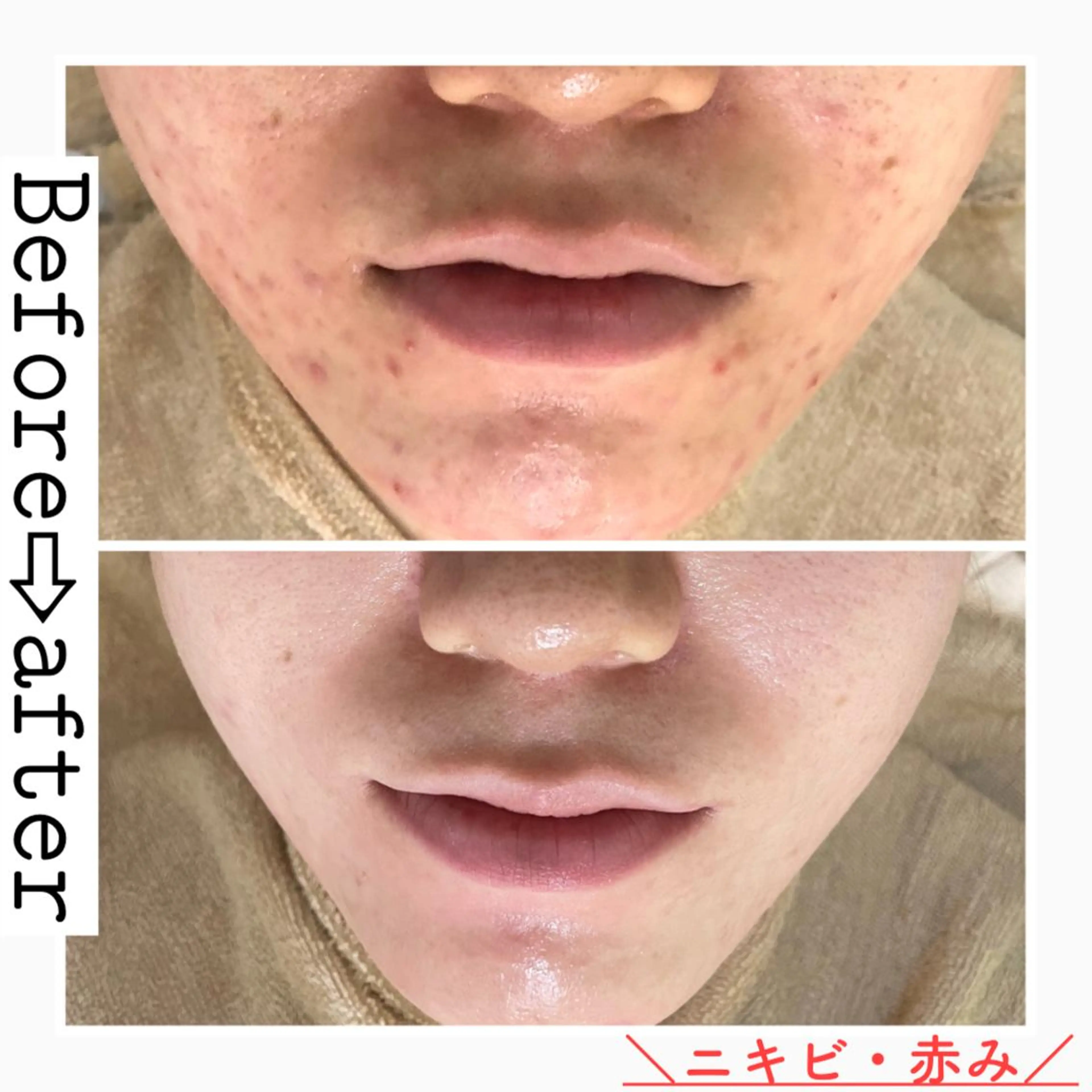 ロング カラー パーマ ヘアアレンジ メンズ キッズ ネイル マツエク・マツパ エステ ニキビ&跡改善サロン オーナー光木のエステ・リラクイメージ