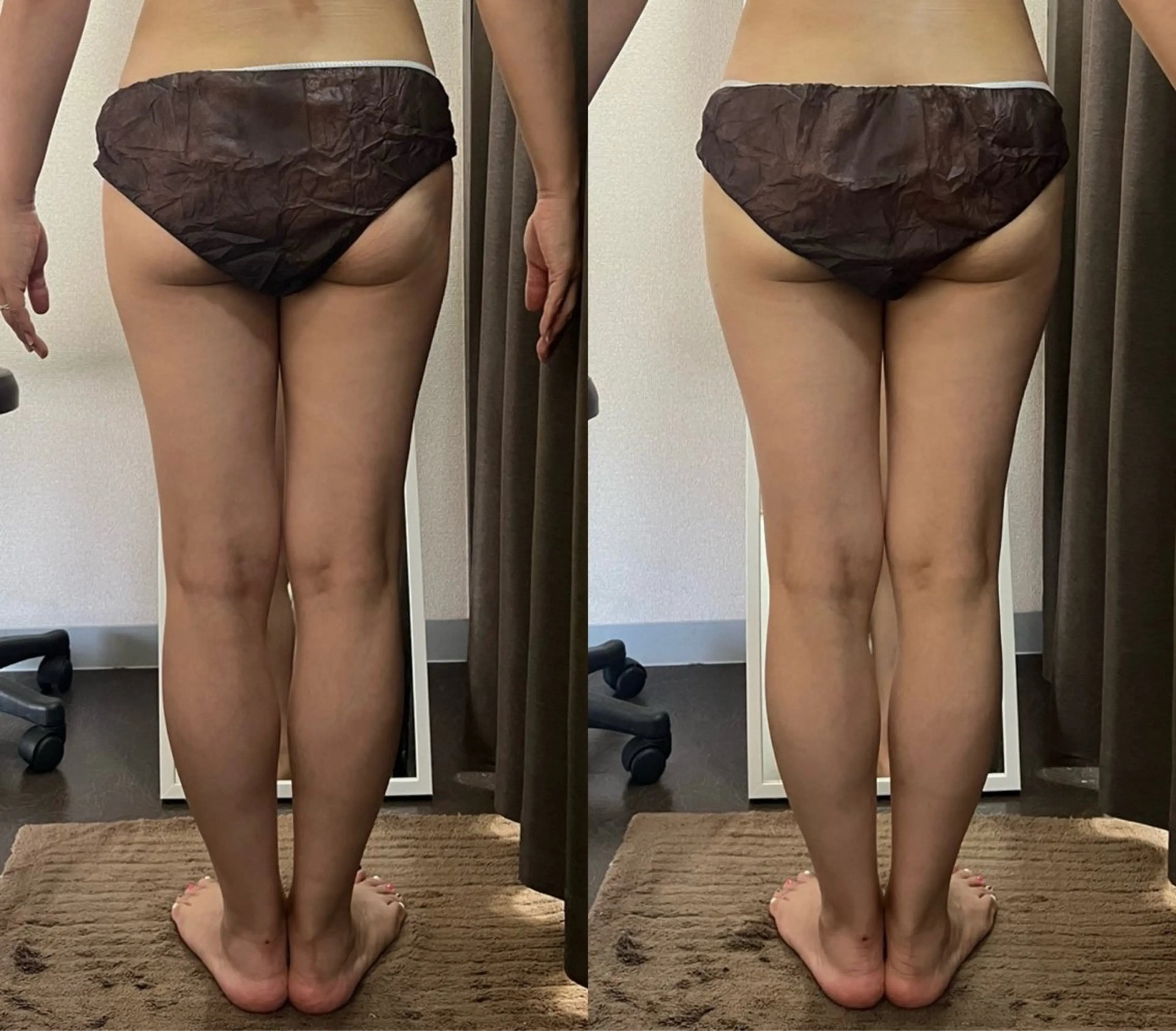 エステ ハイパーナイフ専門店　Salon de COCO所属・Salon de COCOのエステ・リラクイメージ