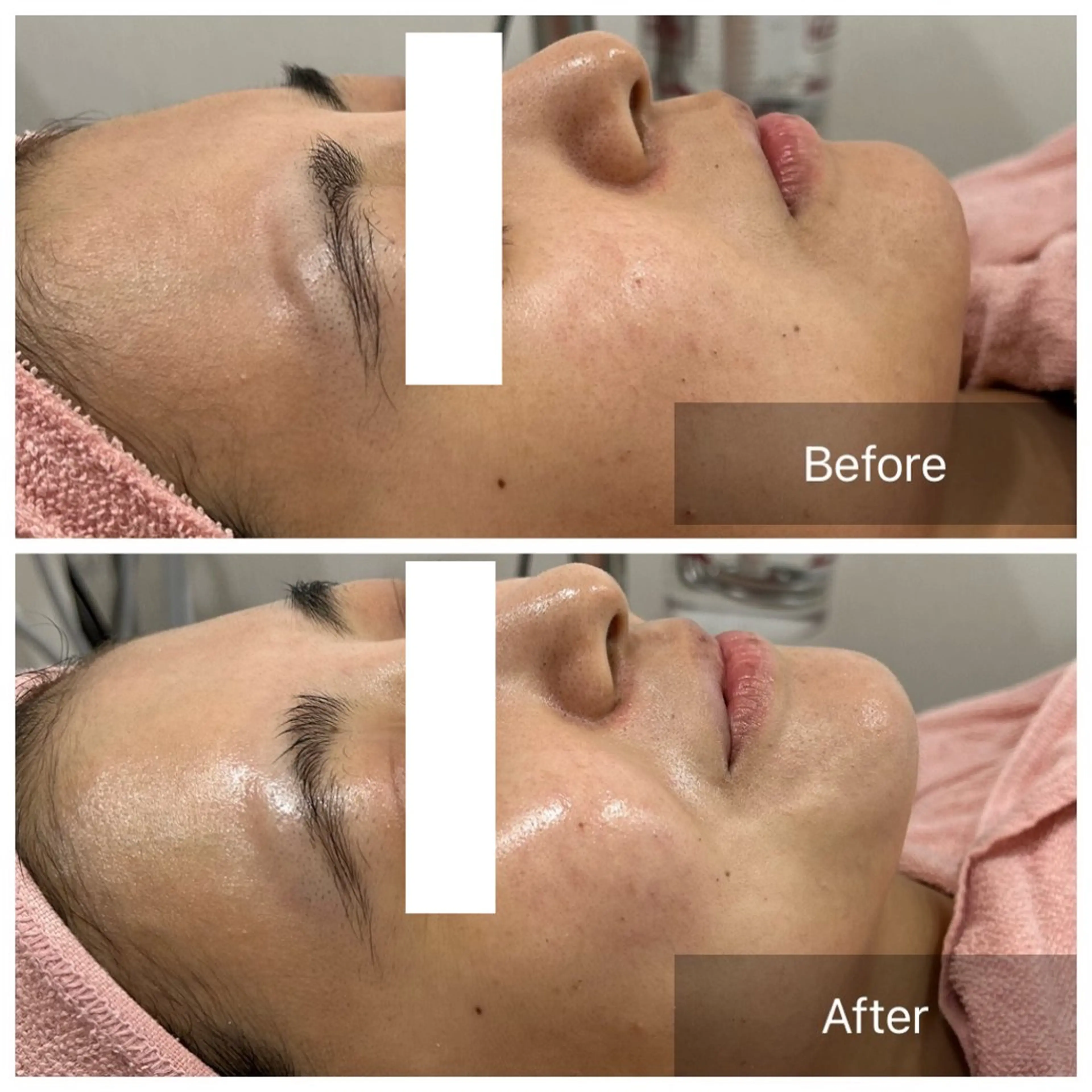 【現役看護師】高来 笑子のエステ・リラクイメージ