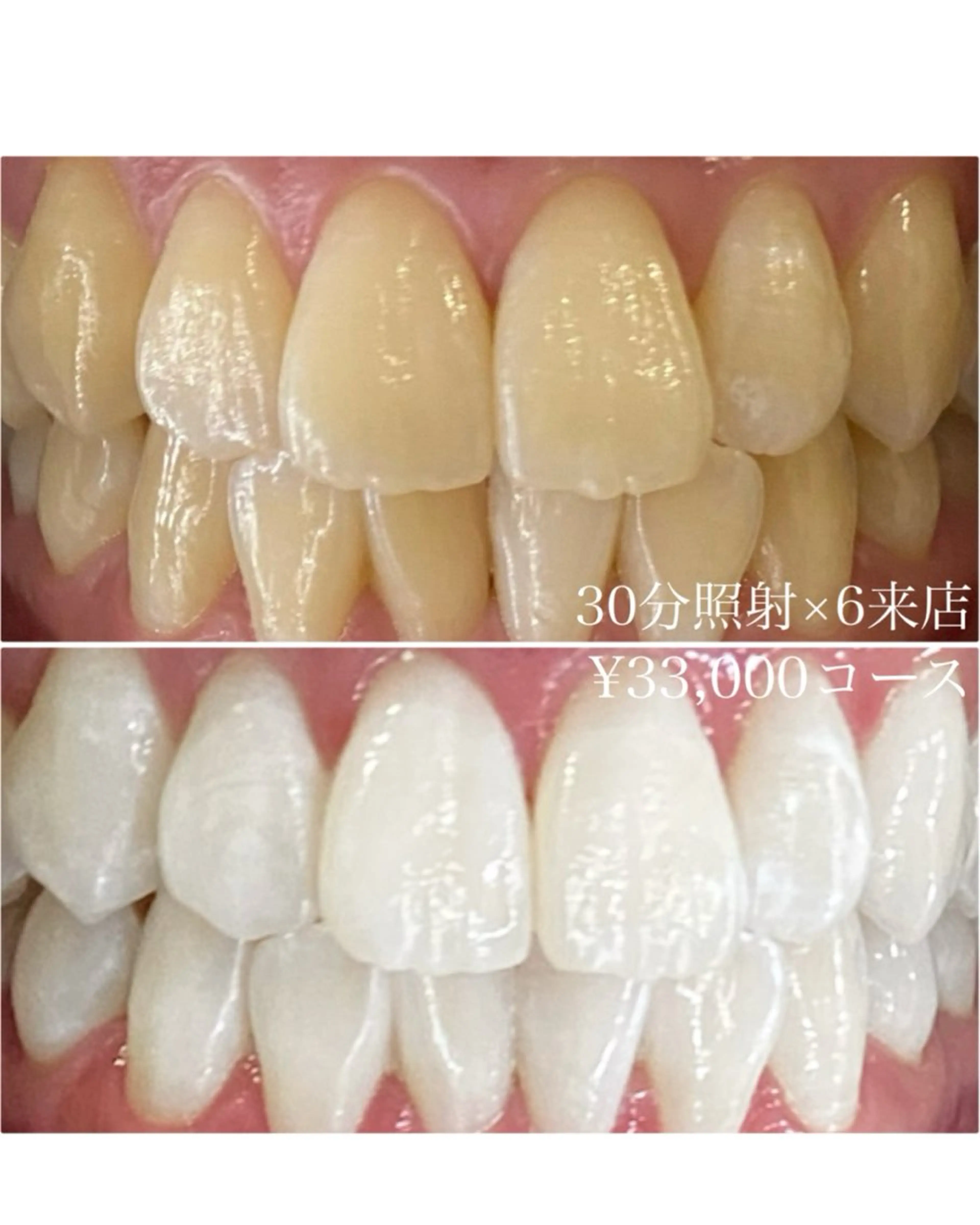 メンズ その他 ホワイトニングルーム　川崎店所属・ホワイトニング ルーム　川崎店のその他イメージ