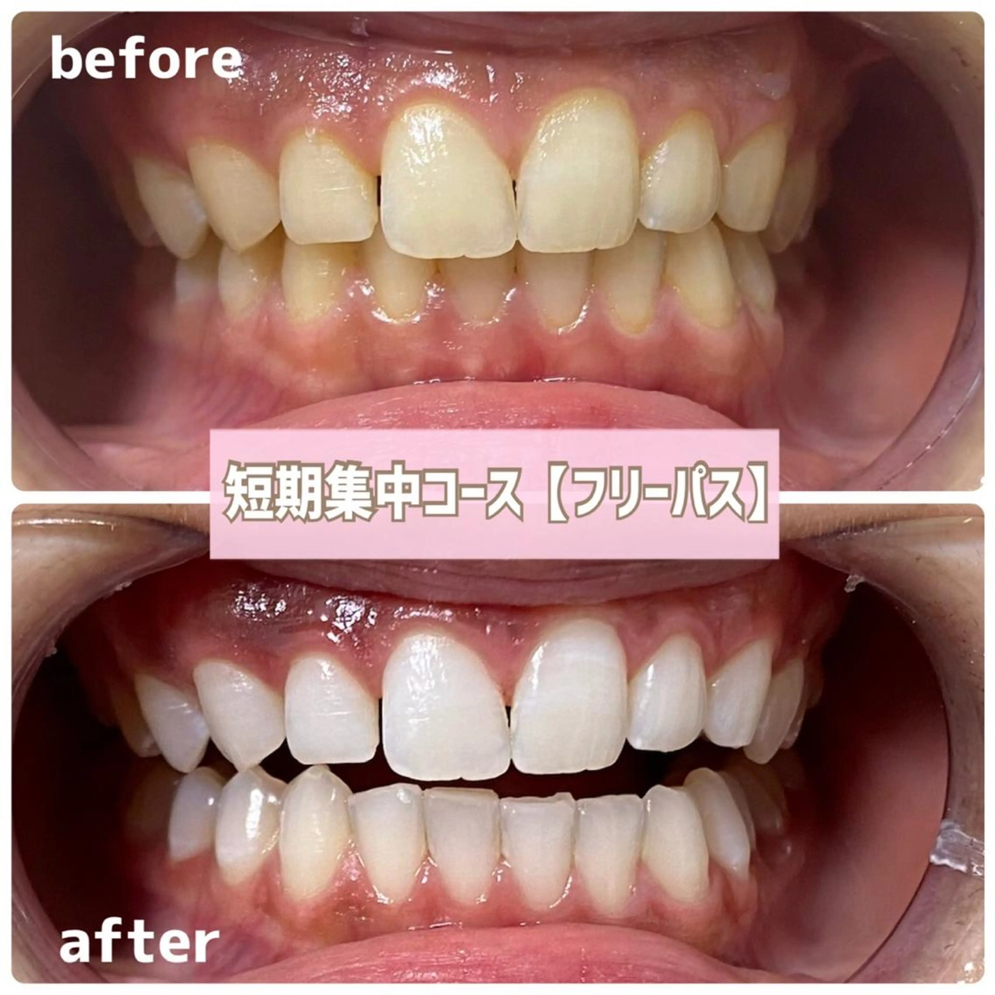 メンズ その他 ホワイトニングサロン BE WHITE金山のその他イメージ