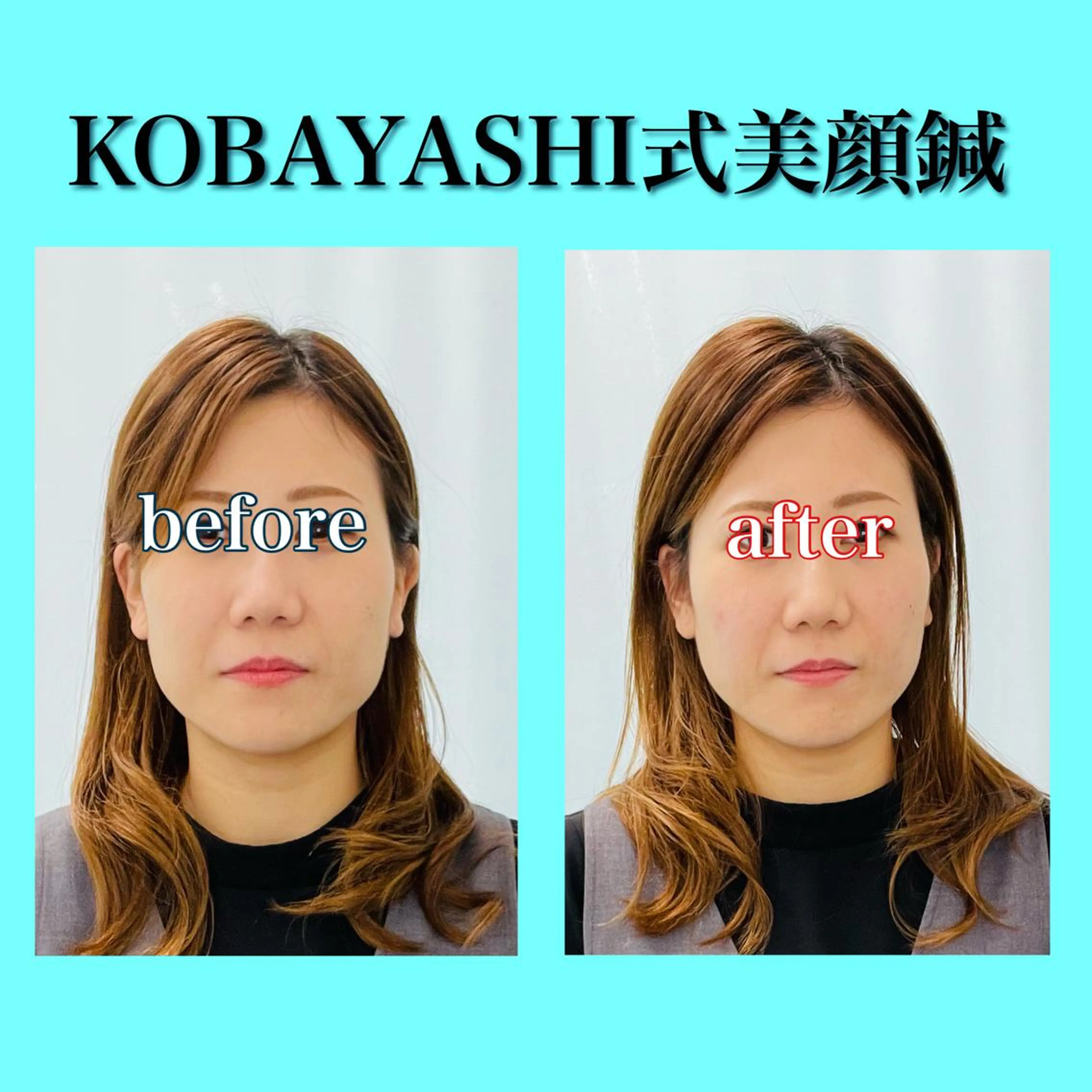 小林整骨院　下総中山所属・津田 龍平のその他イメージ